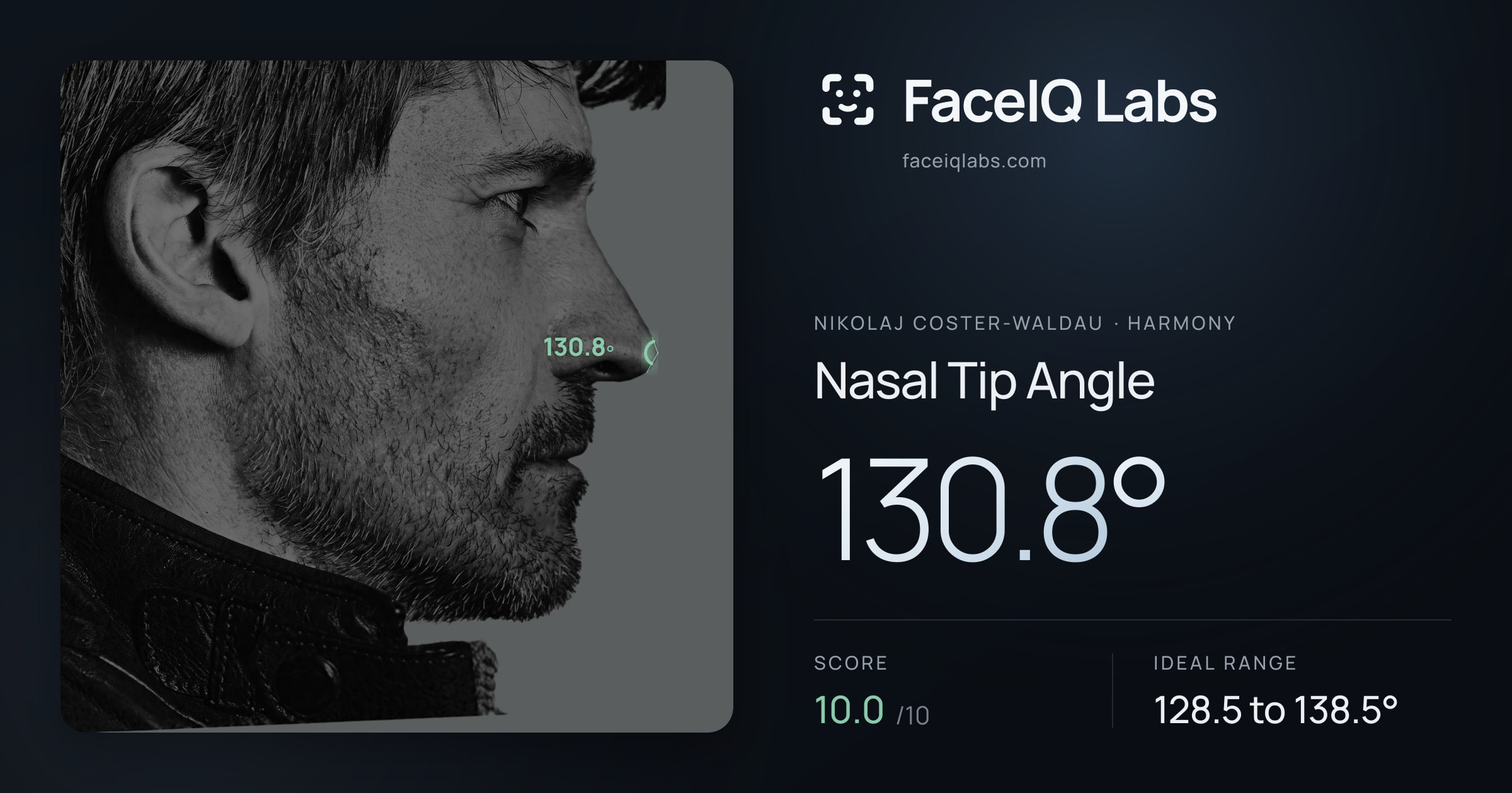 Nikolaj Coster-Waldau Nasal Tip Angle: 130.8°, drawn on the photo