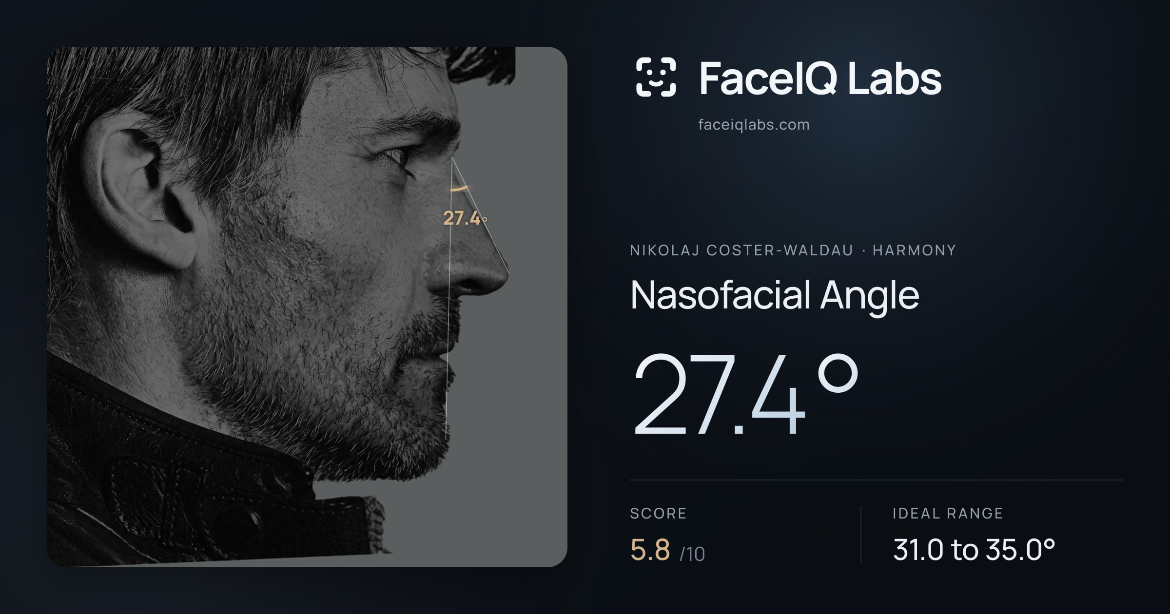 Nikolaj Coster-Waldau Nasofacial Angle: 27.4°, drawn on the photo