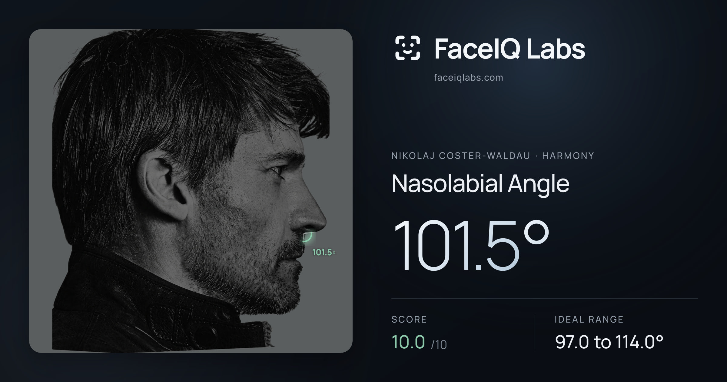 Nikolaj Coster-Waldau Nasolabial Angle: 101.5°, drawn on the photo