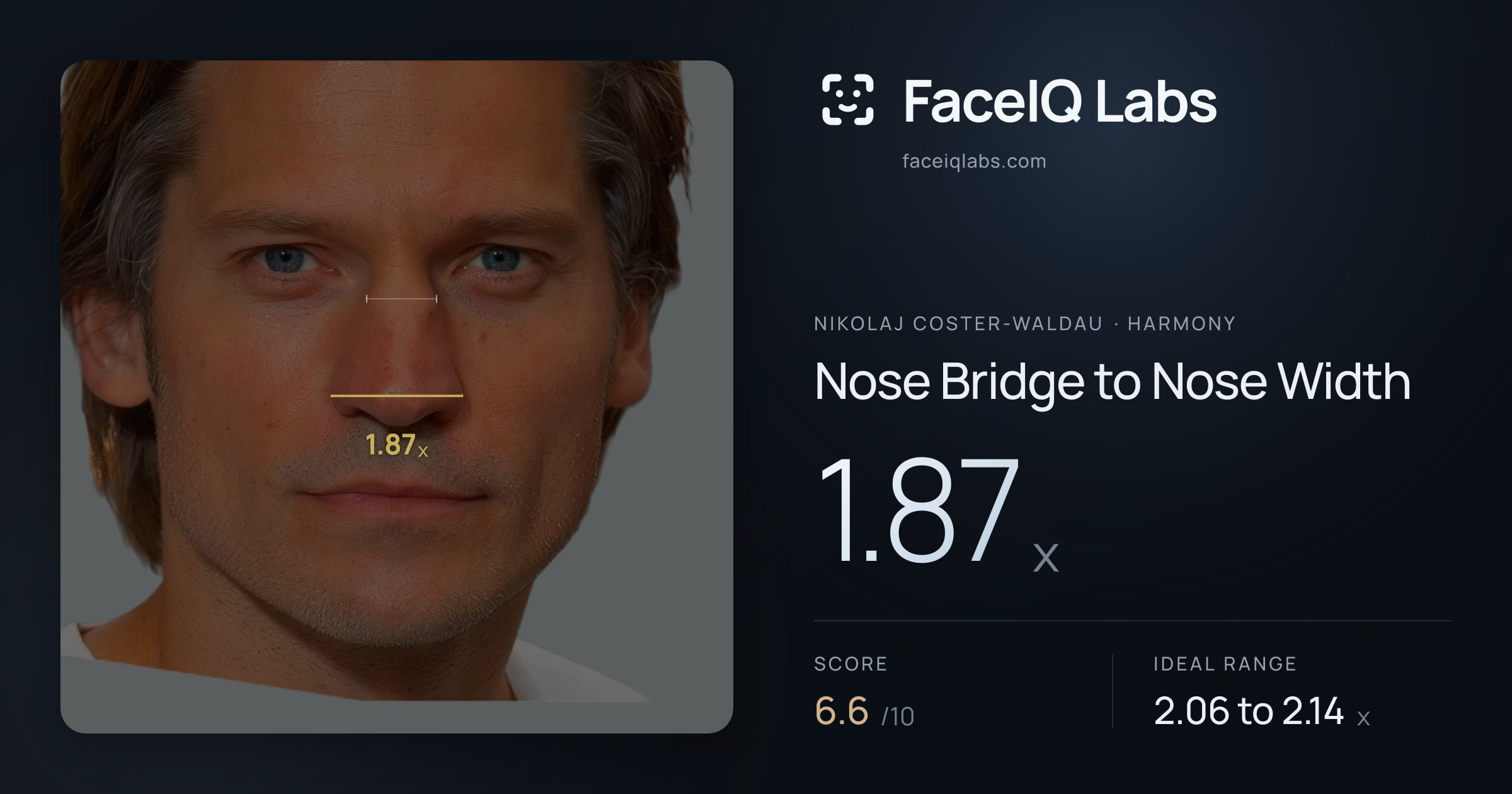 Nikolaj Coster-Waldau Nose Bridge to Nose Width: 1.87x, drawn on the photo