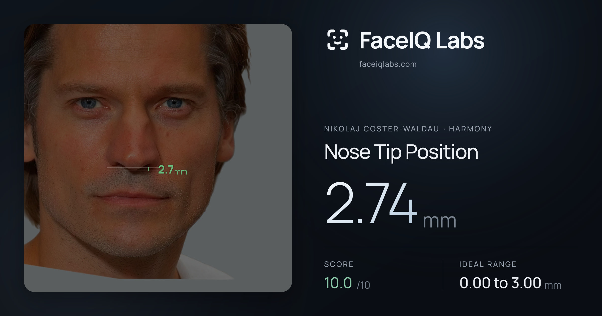 Nikolaj Coster-Waldau Nose Tip Position: 2.74mm, drawn on the photo