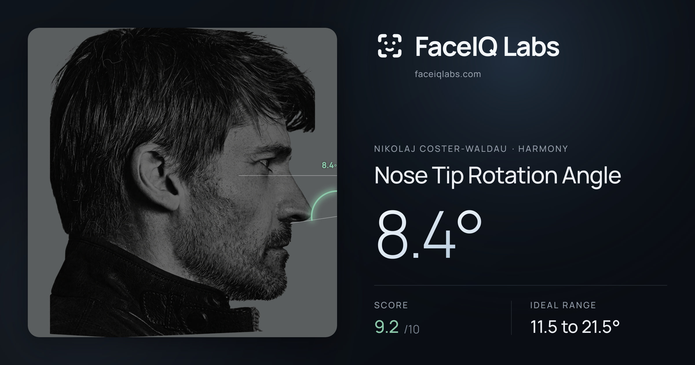 Nikolaj Coster-Waldau Nose Tip Rotation Angle: 8.4°, drawn on the photo