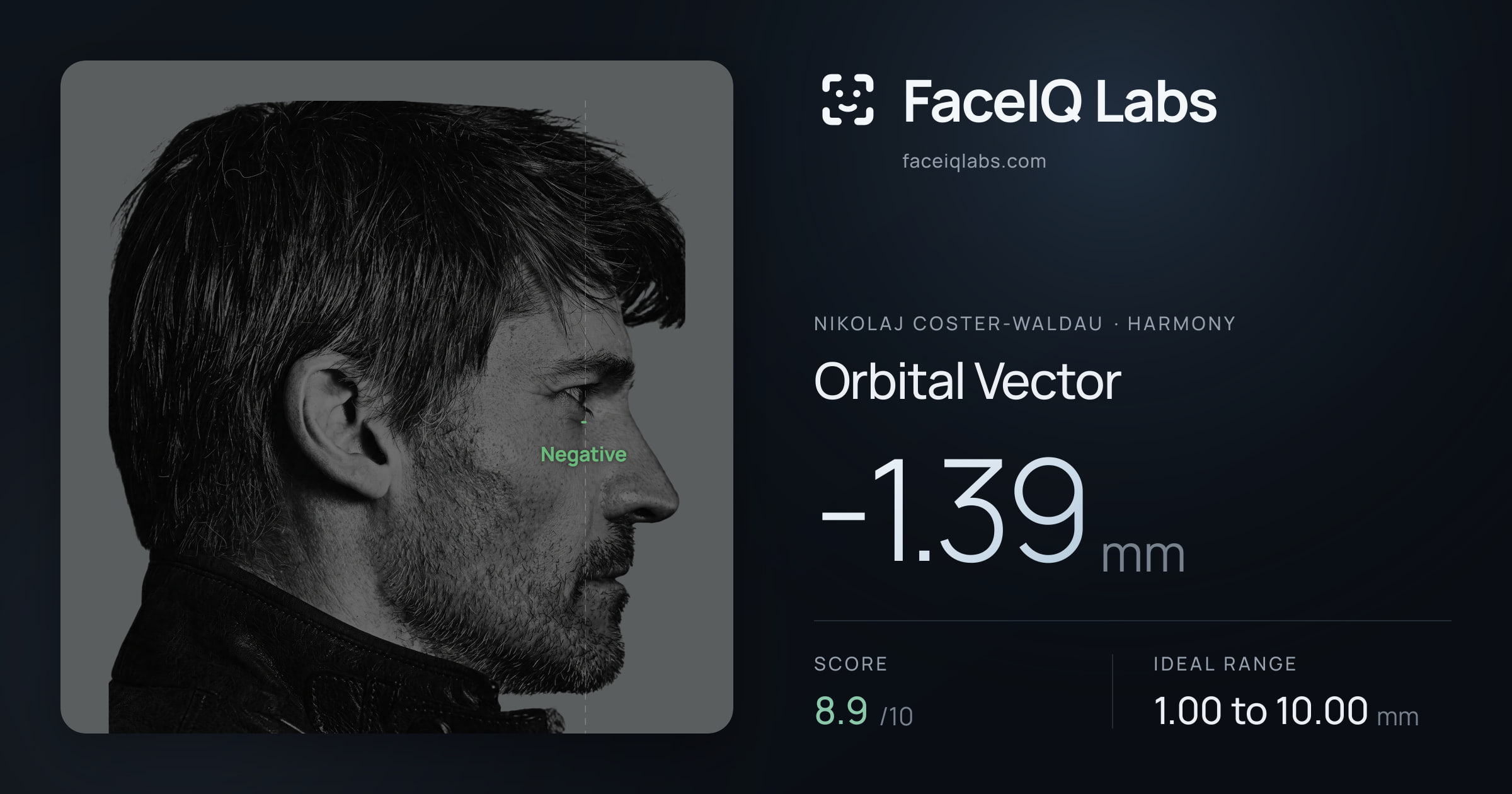 Nikolaj Coster-Waldau Orbital Vector: -1.39mm, drawn on the photo