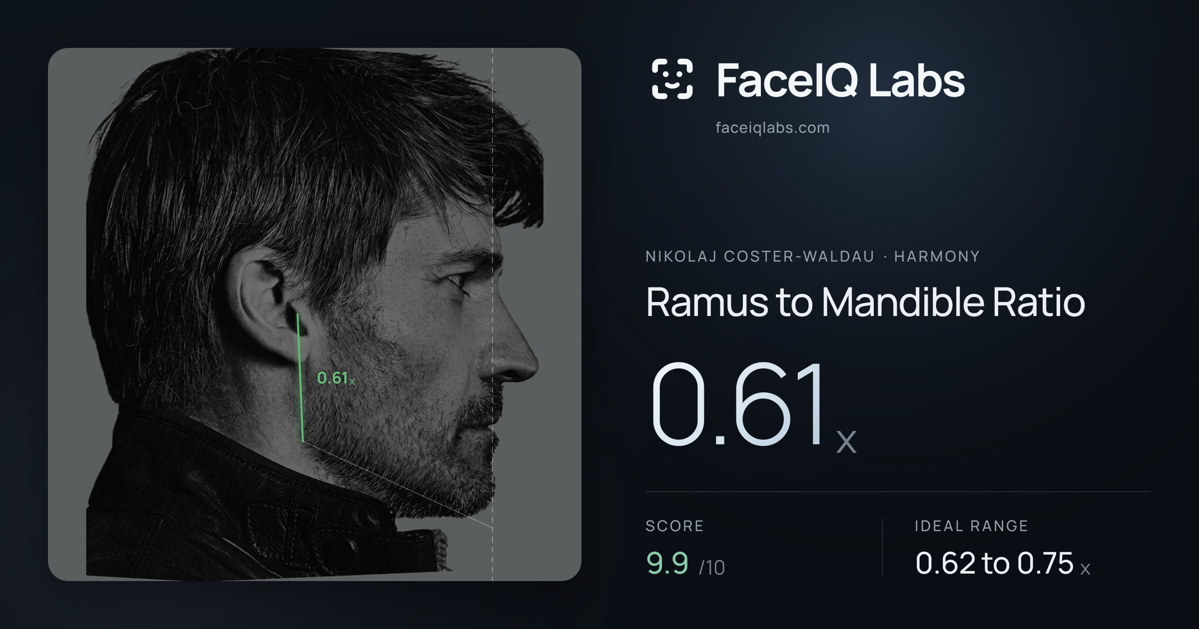 Nikolaj Coster-Waldau Ramus to Mandible Ratio: 0.61x, drawn on the photo