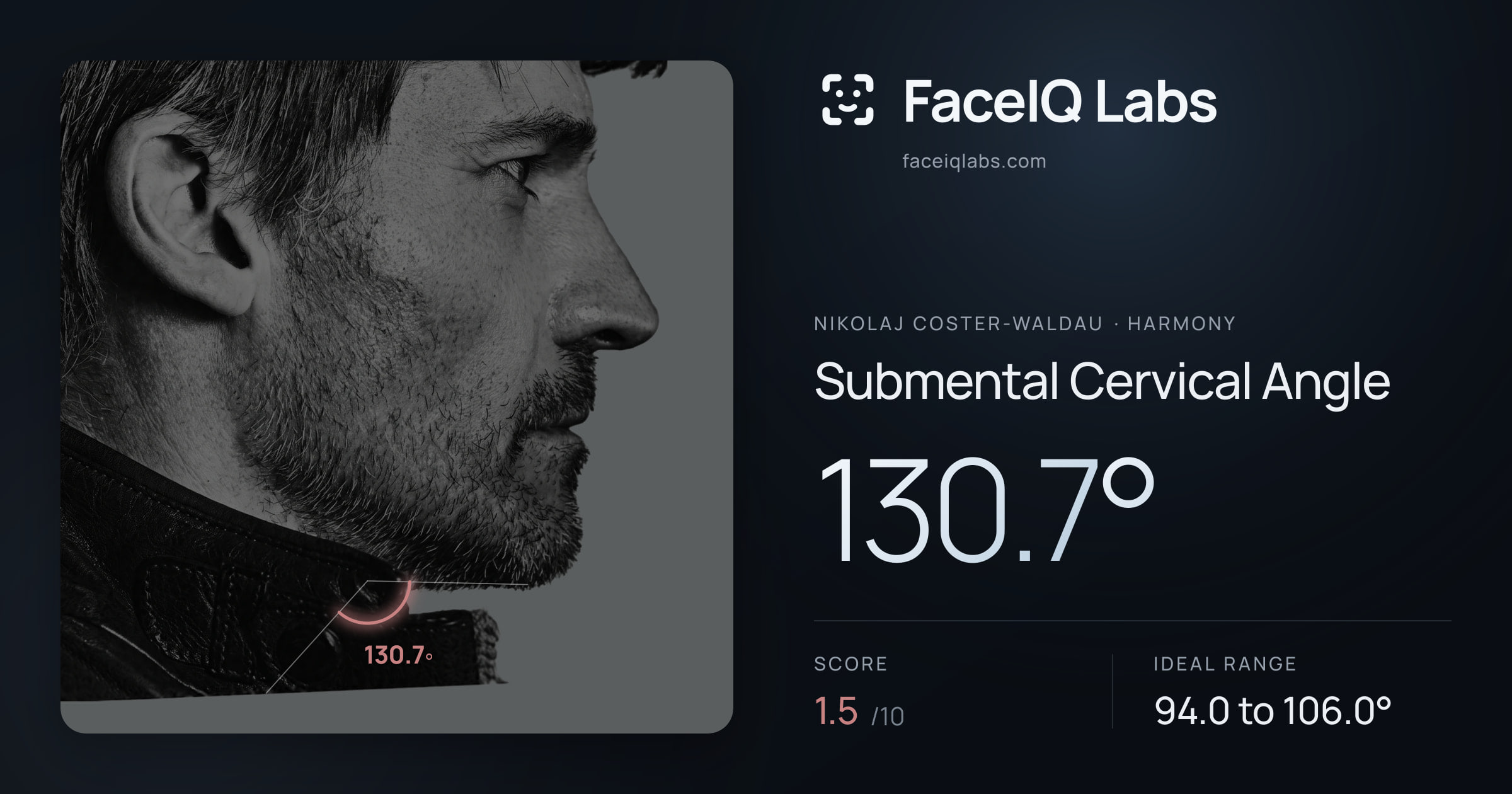 Nikolaj Coster-Waldau Submental Cervical Angle: 130.7°, drawn on the photo