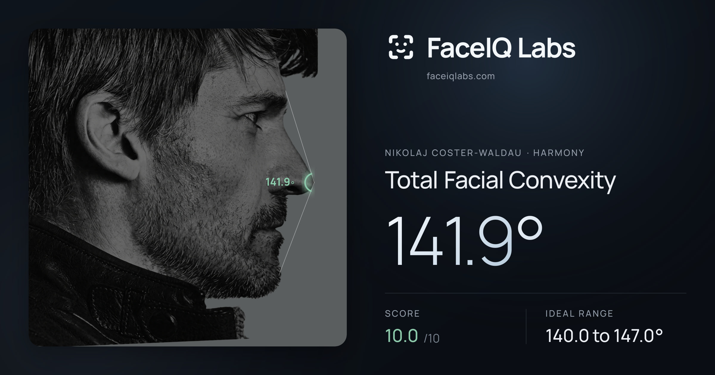 Nikolaj Coster-Waldau Total Facial Convexity: 141.9°, drawn on the photo