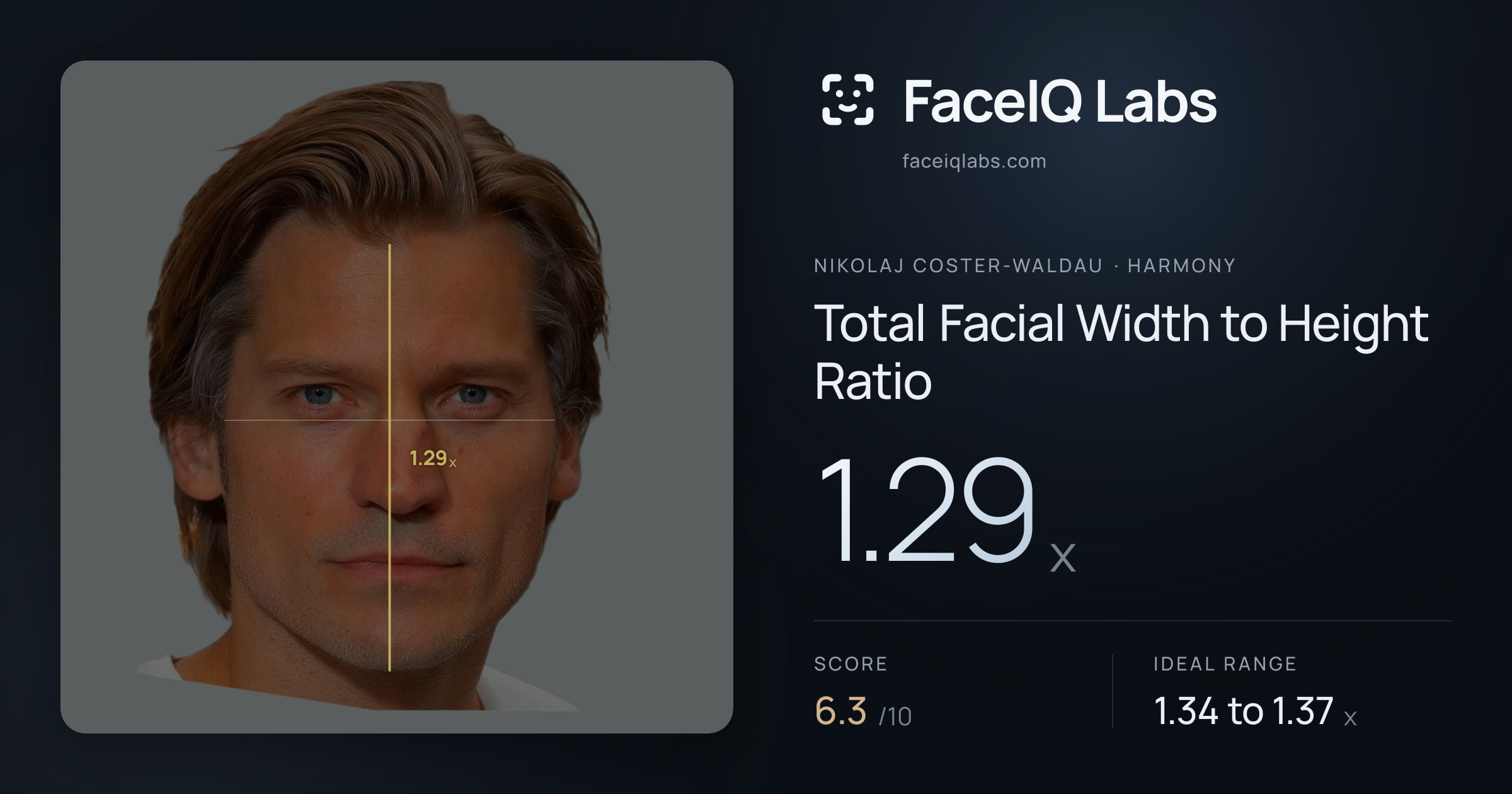 Nikolaj Coster-Waldau Total Facial Width to Height Ratio: 1.29x, drawn on the photo
