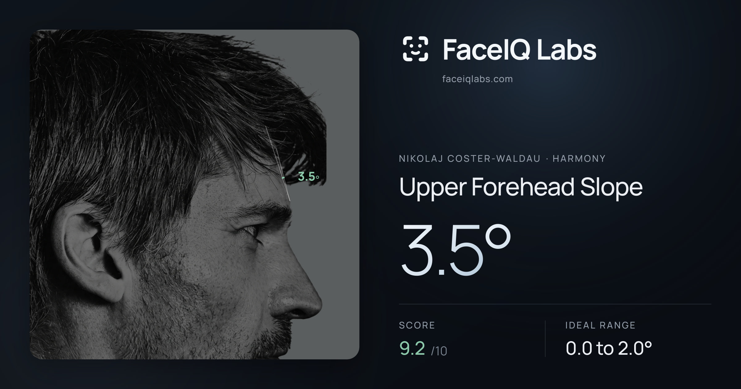 Nikolaj Coster-Waldau Upper Forehead Slope: 3.5°, drawn on the photo