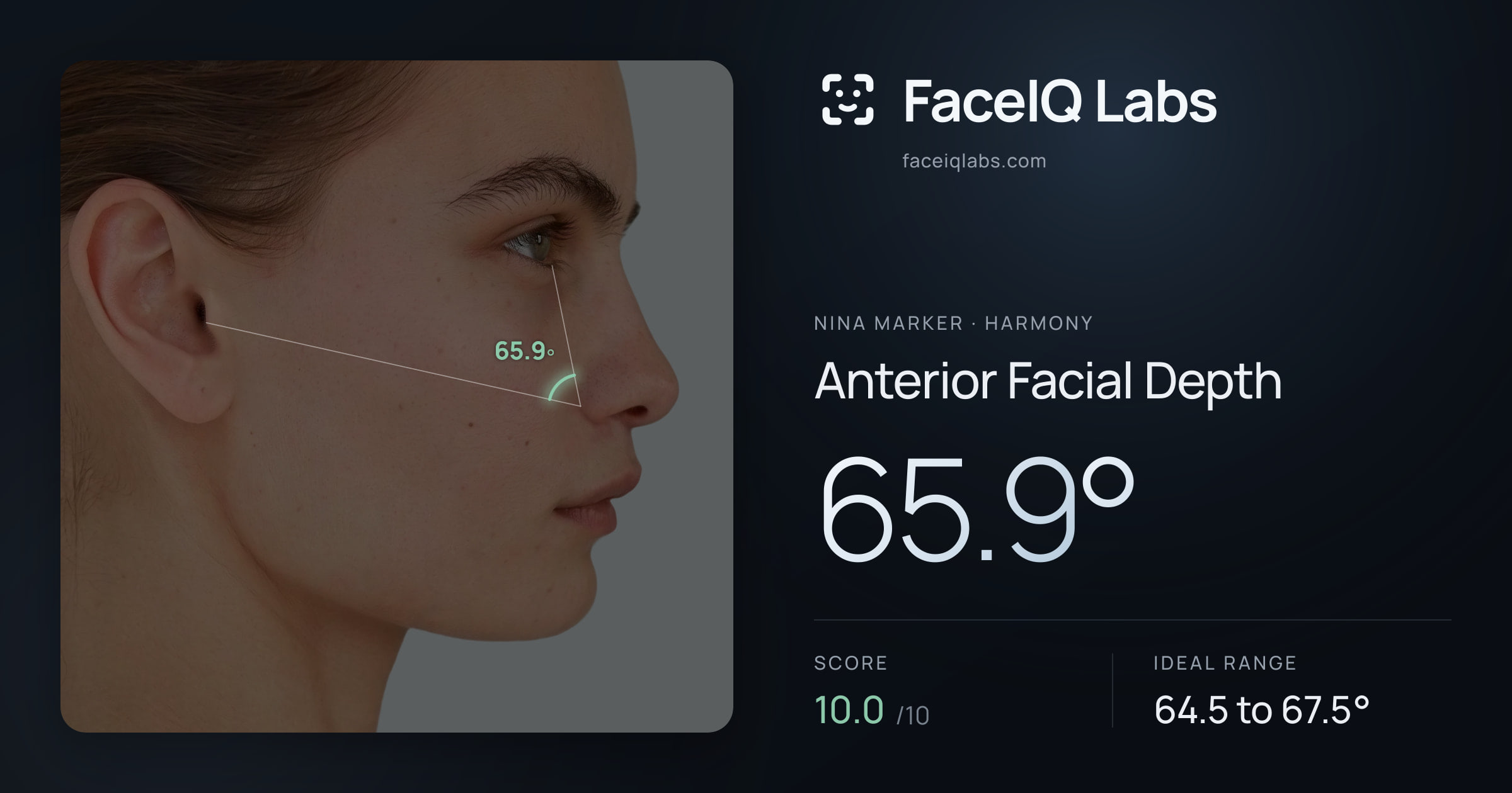 Nina Marker Anterior Facial Depth: 65.9°, drawn on the photo