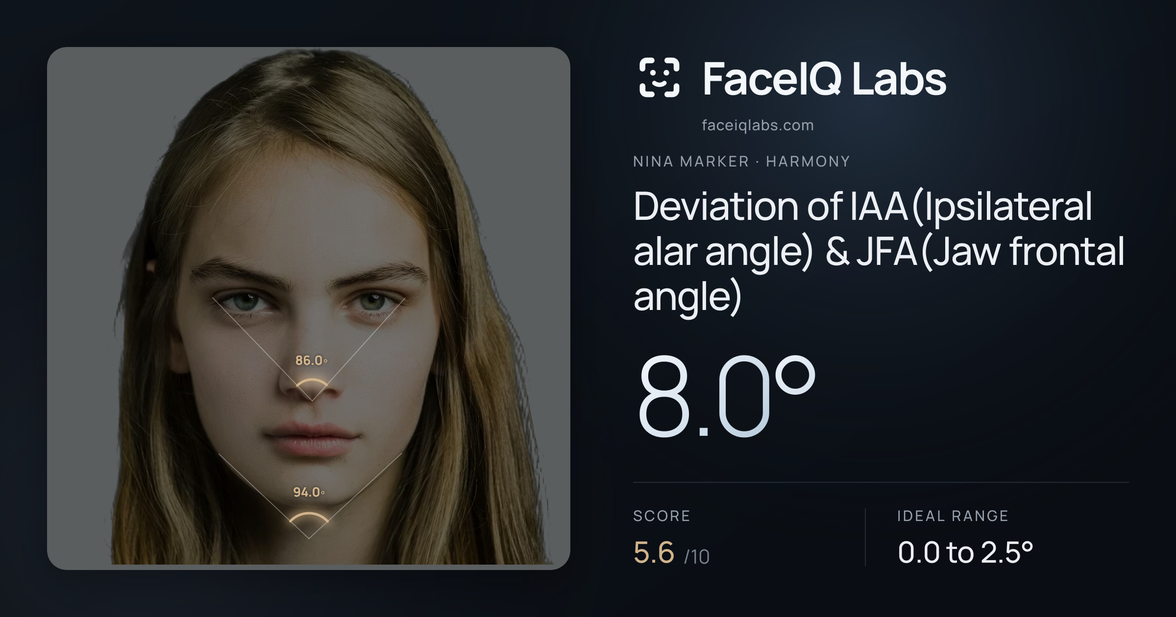 Nina Marker Deviation of IAA(Ipsilateral alar angle) & JFA(Jaw frontal angle): 8.0°, drawn on the photo