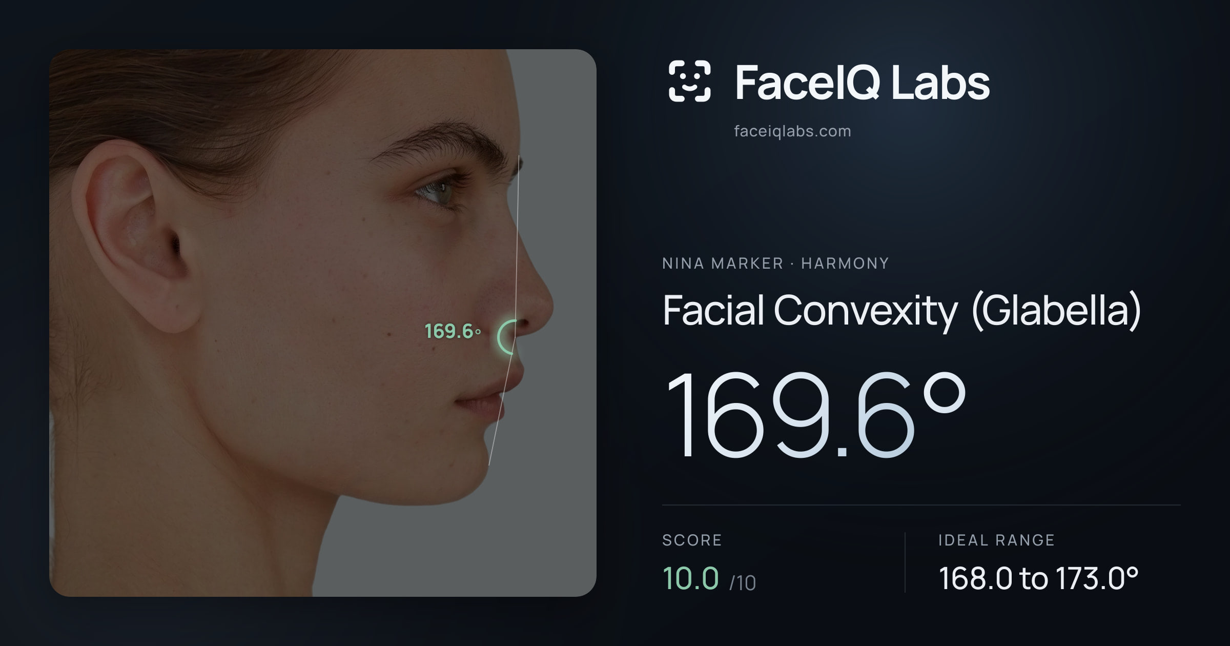Nina Marker Facial Convexity (Glabella): 169.6°, drawn on the photo