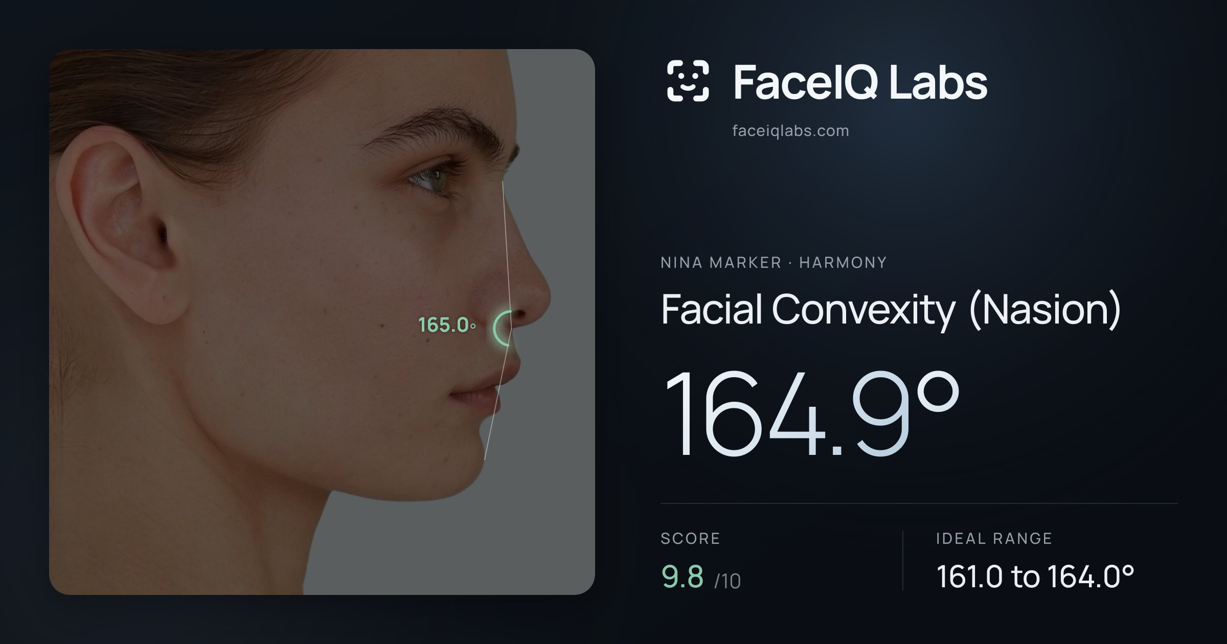 Nina Marker Facial Convexity (Nasion): 164.9°, drawn on the photo