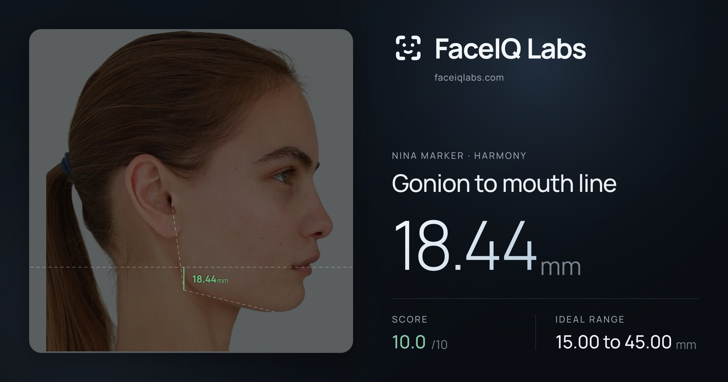 Nina Marker Gonion to mouth line: 18.44mm, drawn on the photo