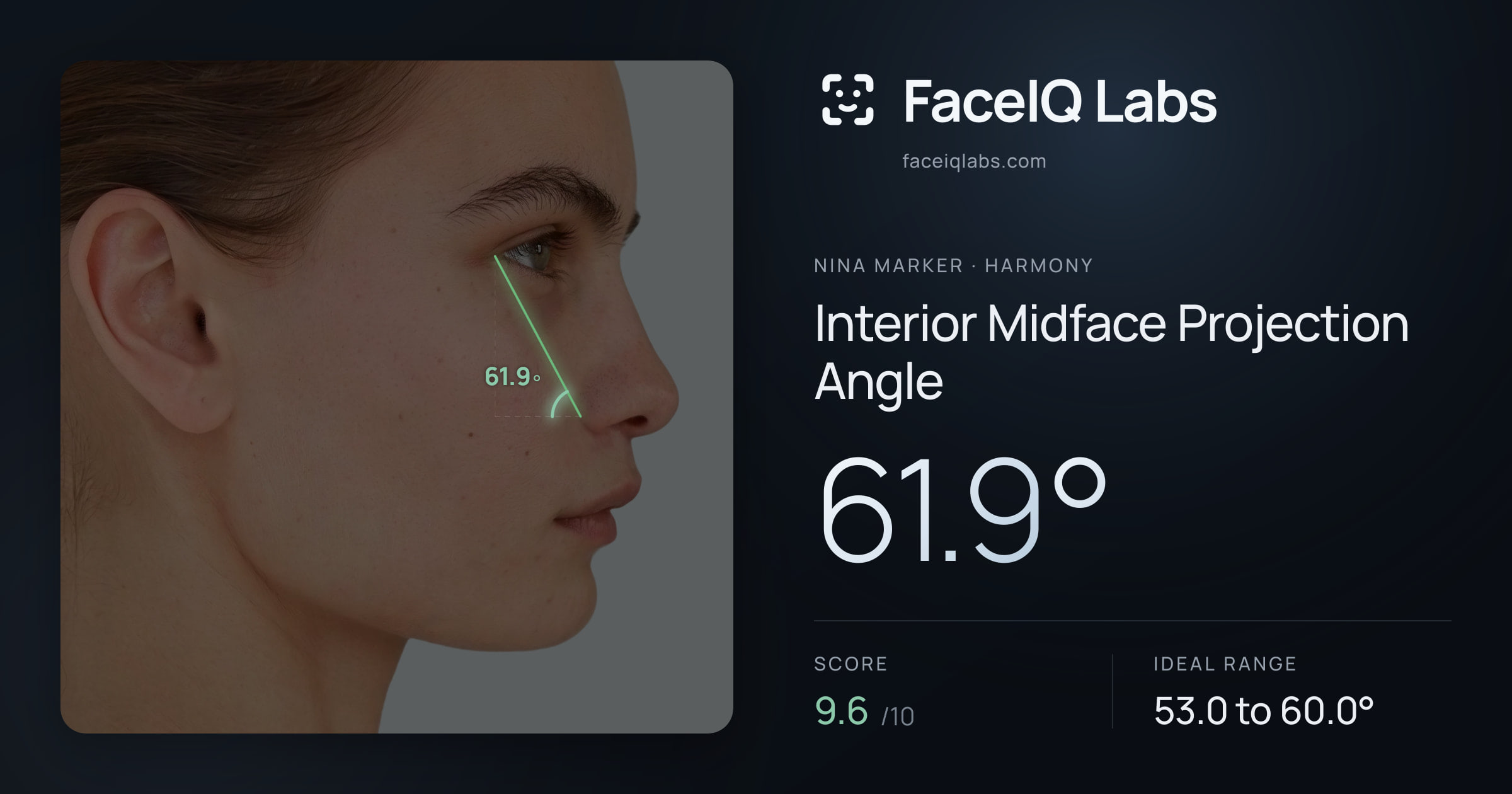 Nina Marker Interior Midface Projection Angle: 61.9°, drawn on the photo