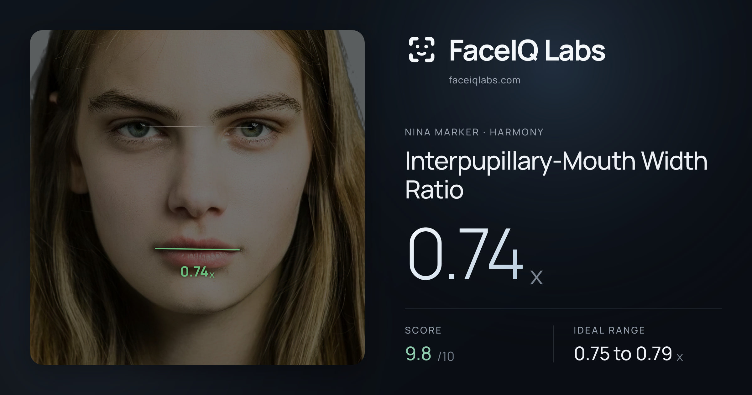 Nina Marker Interpupillary-Mouth Width Ratio: 0.74x, drawn on the photo