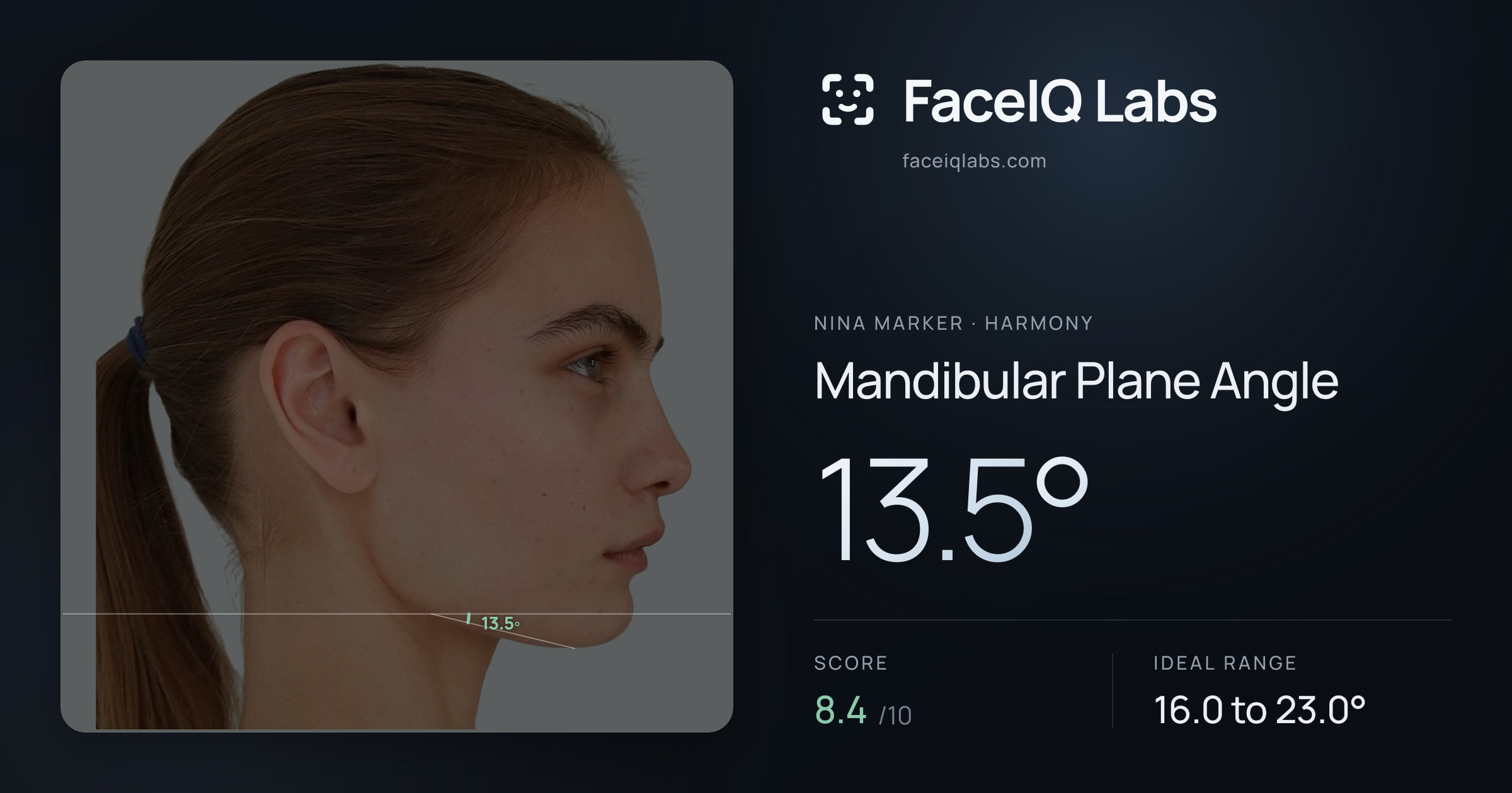 Nina Marker Mandibular Plane Angle: 13.5°, drawn on the photo