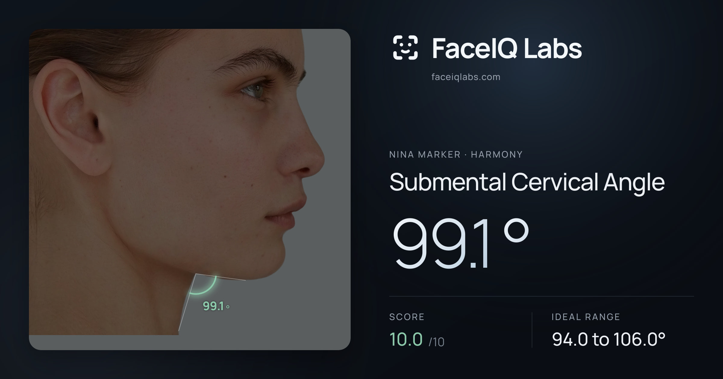 Nina Marker Submental Cervical Angle: 99.1°, drawn on the photo