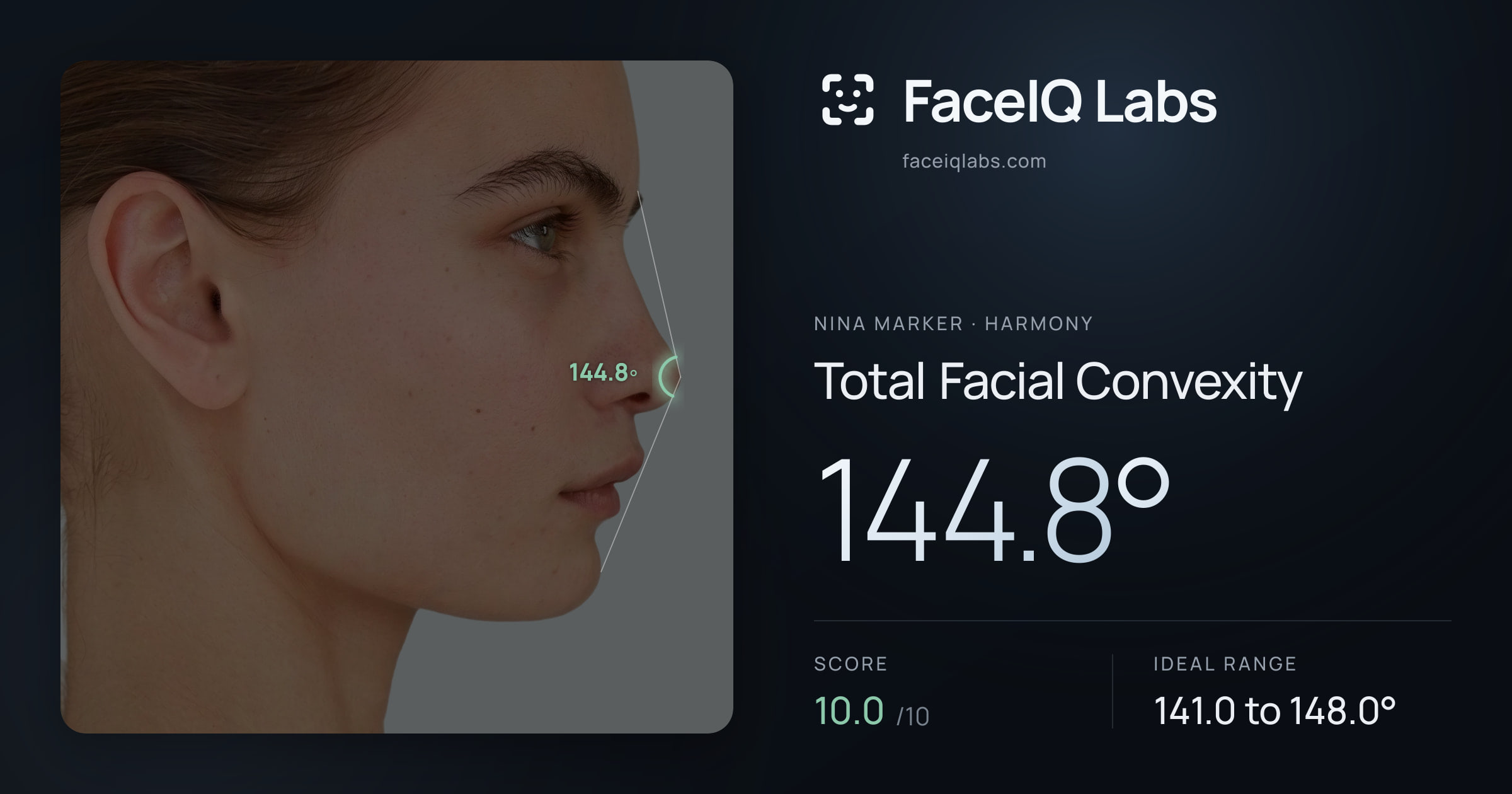 Nina Marker Total Facial Convexity: 144.8°, drawn on the photo