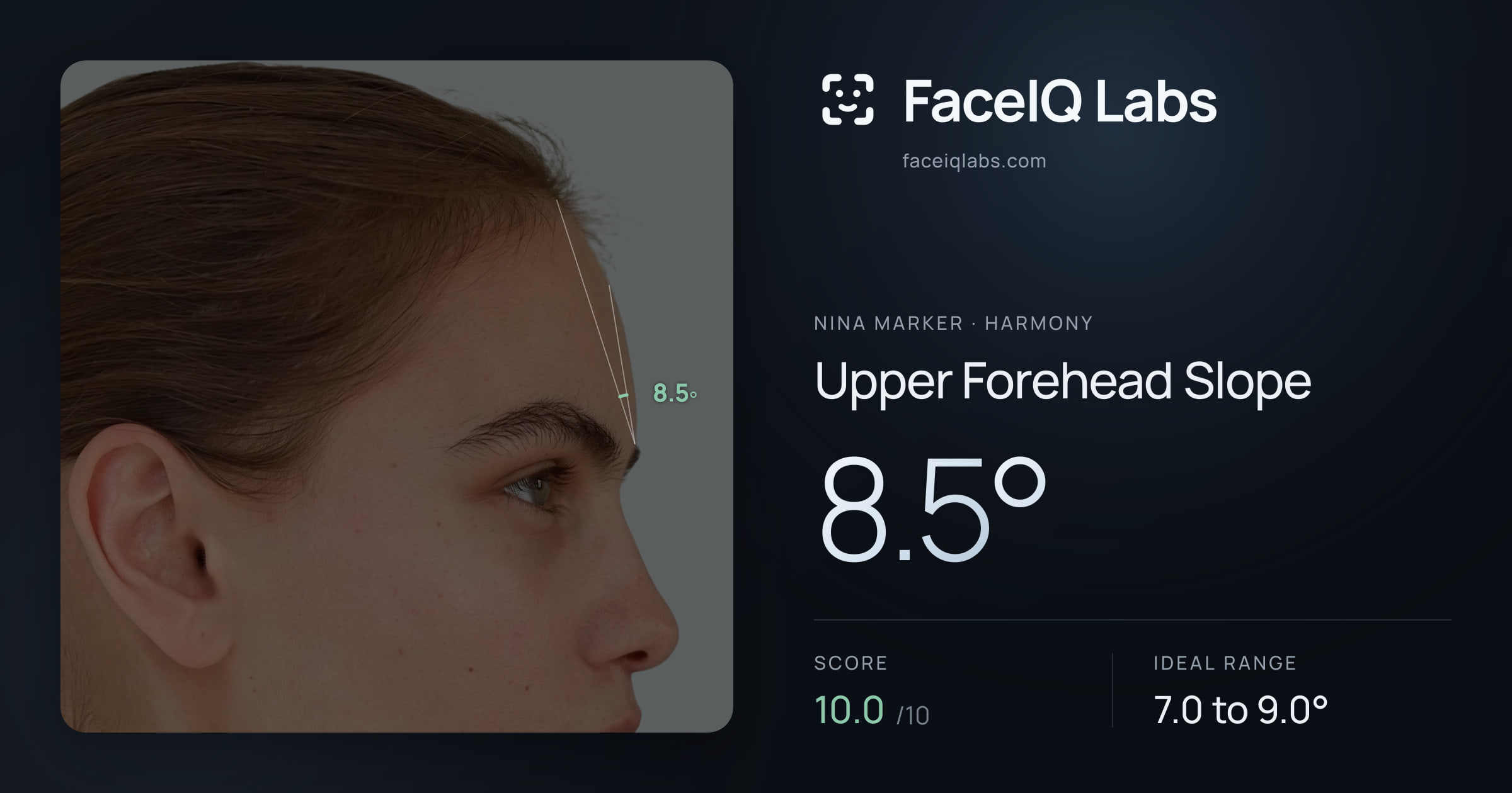 Nina Marker Upper Forehead Slope: 8.5°, drawn on the photo