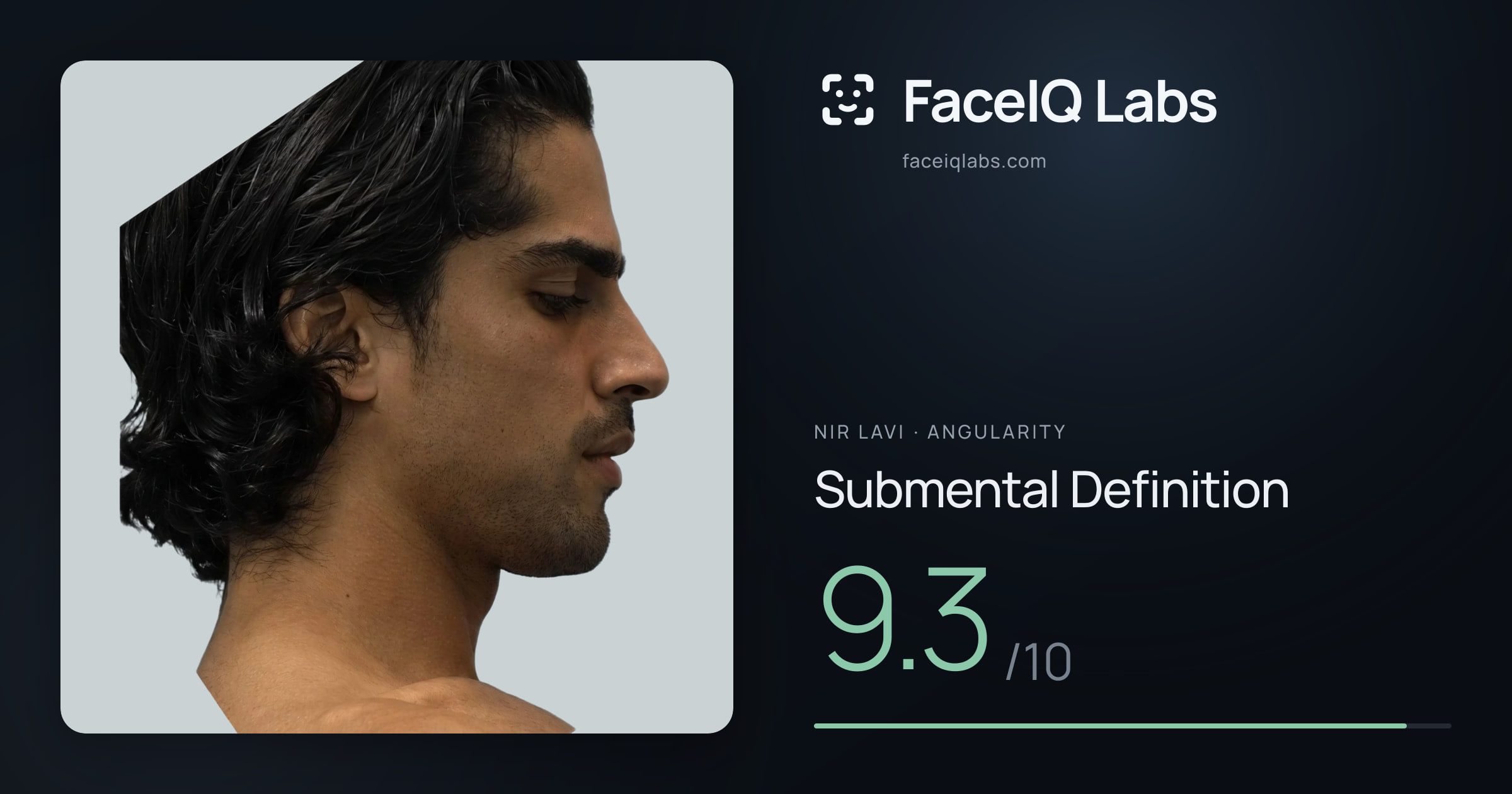 Nir Lavi Submental Definition: 9.3/10, drawn on the photo