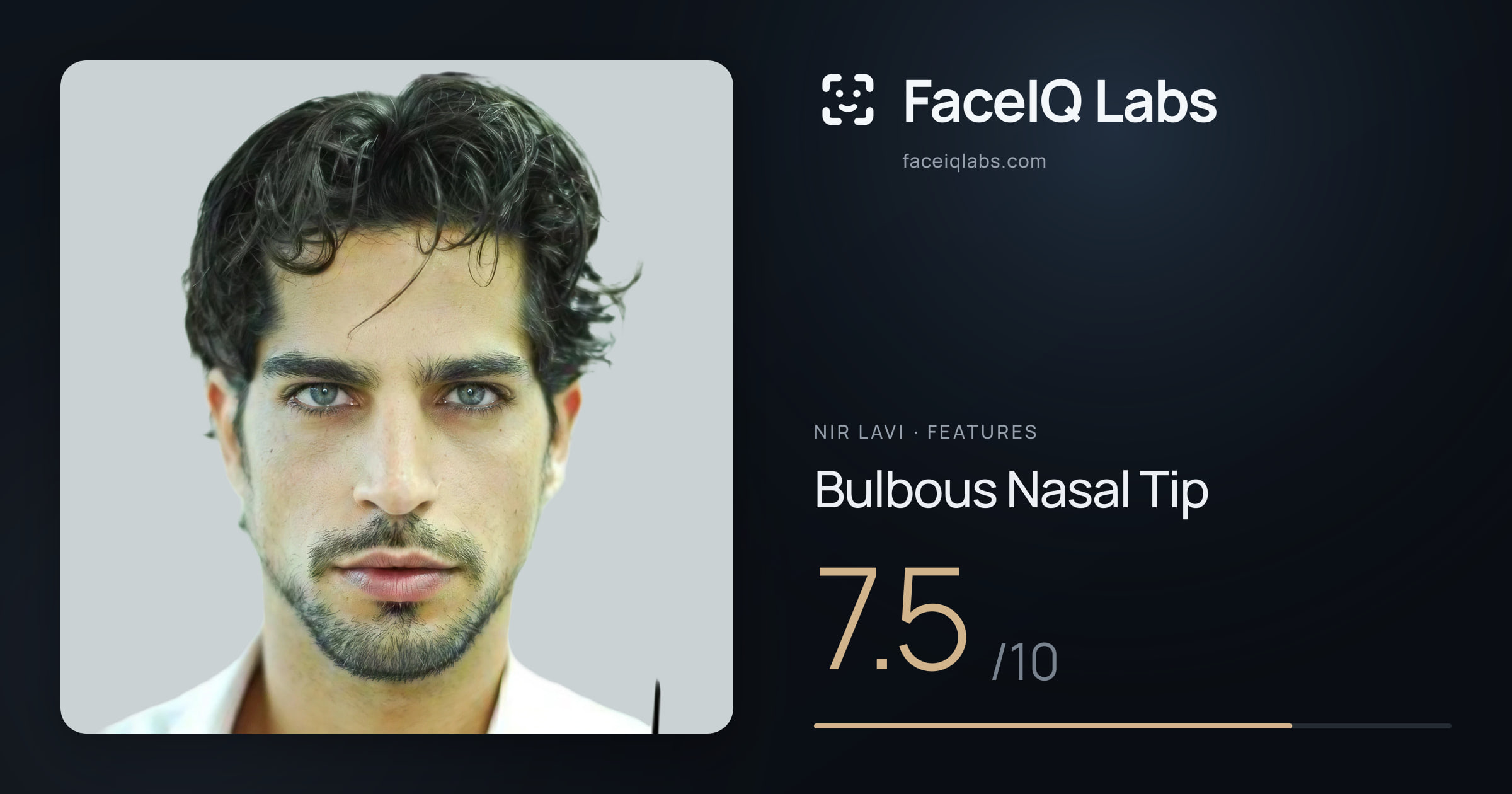 Nir Lavi Bulbous Nasal Tip: 7.5/10, drawn on the photo