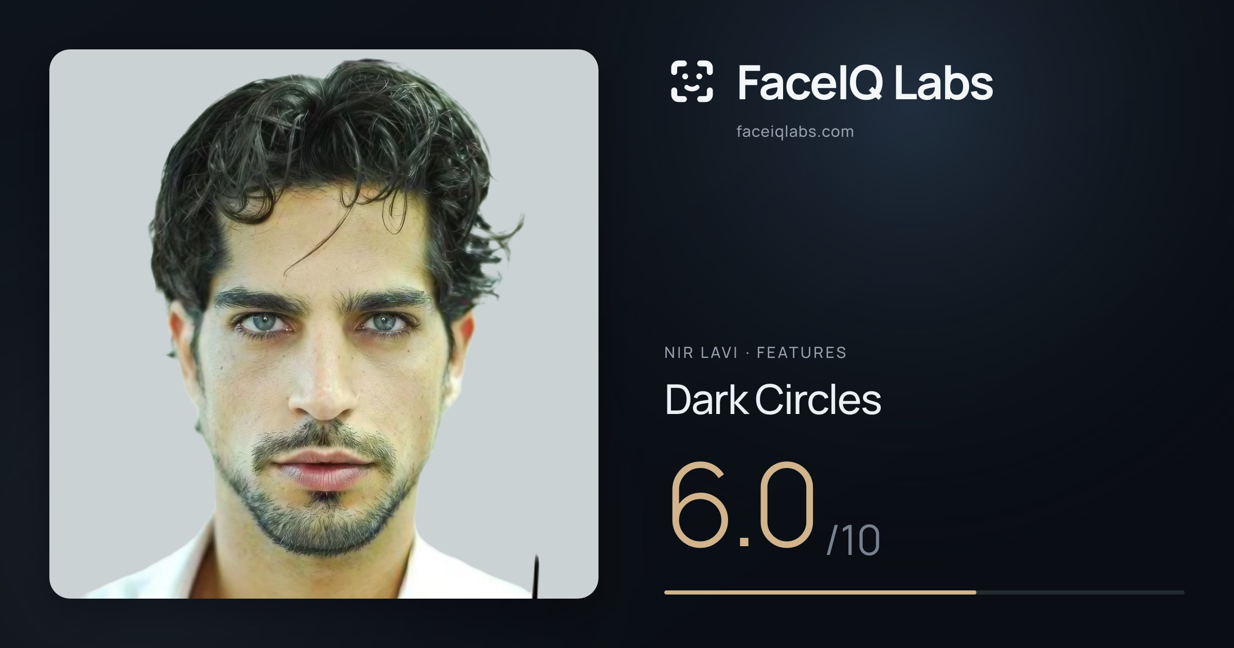 Nir Lavi Dark Circles: 6.0/10, drawn on the photo