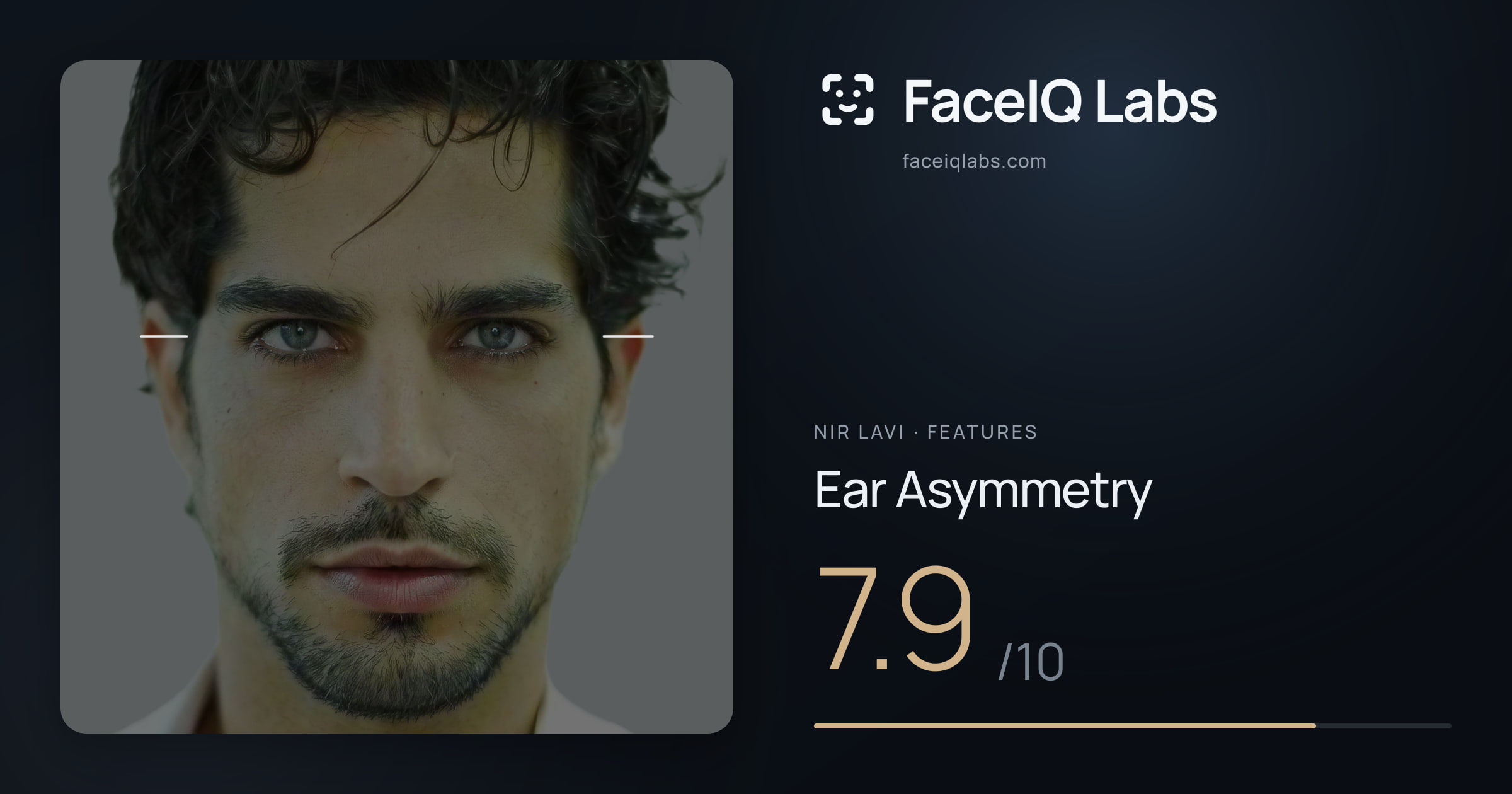 Nir Lavi Ear Asymmetry: 7.9/10, drawn on the photo