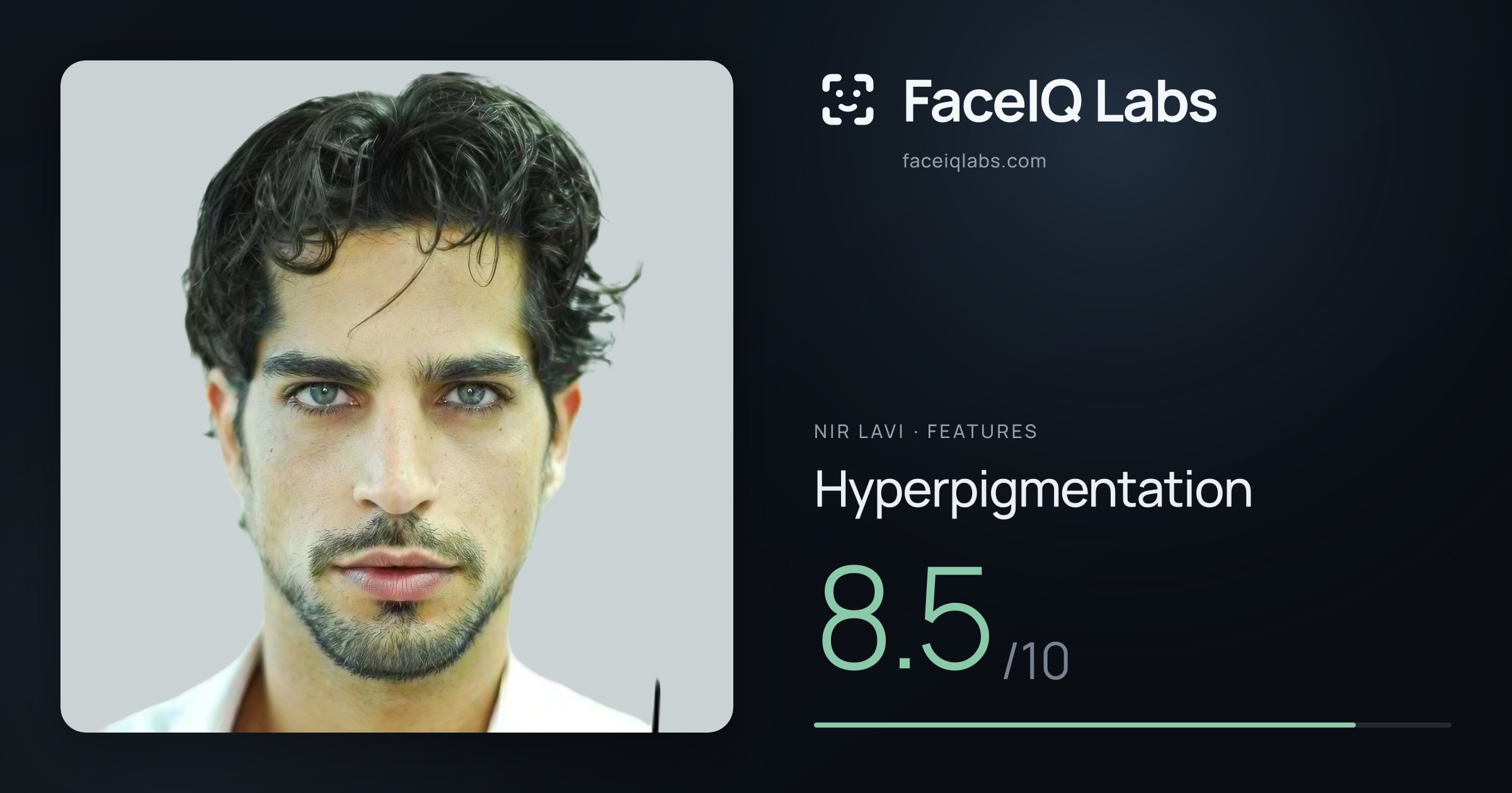 Nir Lavi Hyperpigmentation: 8.5/10, drawn on the photo