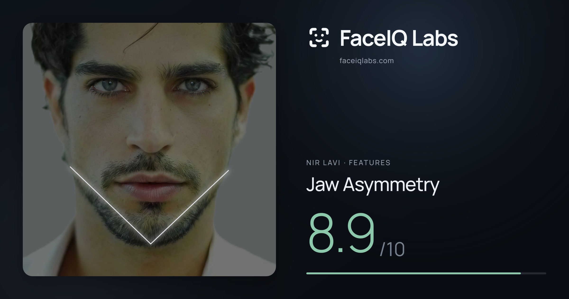 Nir Lavi Jaw Asymmetry: 8.9/10, drawn on the photo