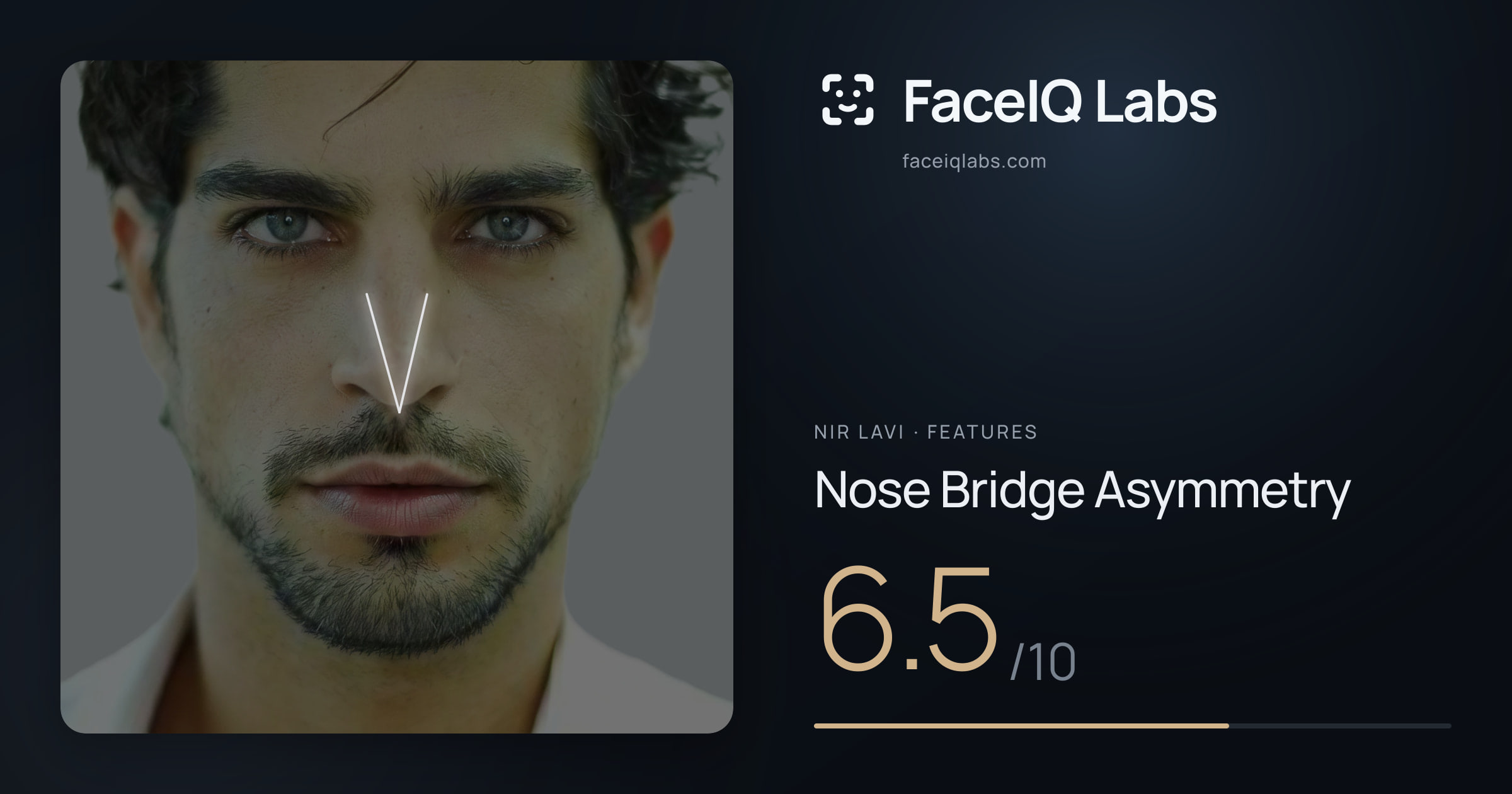 Nir Lavi Nose Bridge Asymmetry: 6.5/10, drawn on the photo