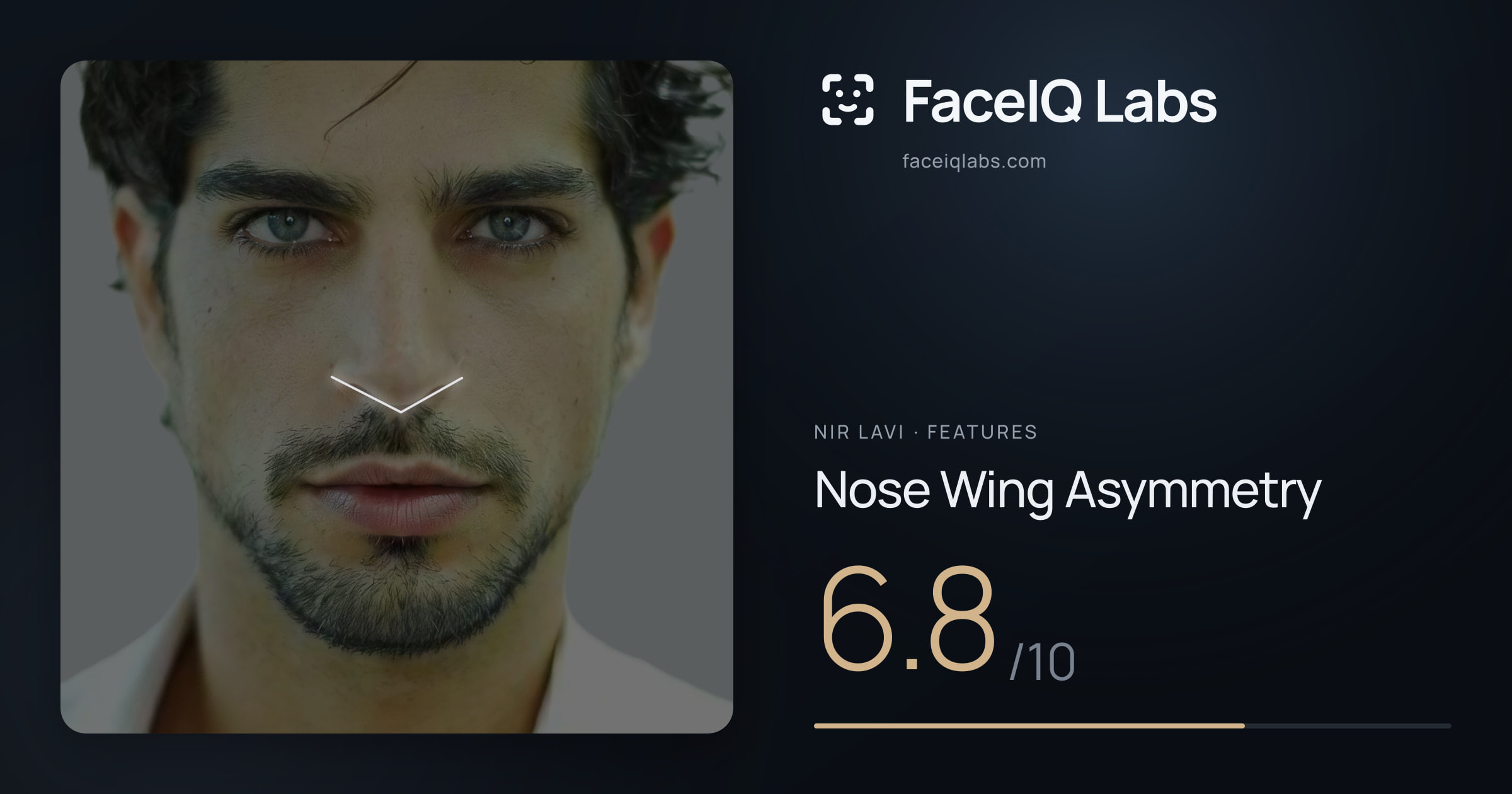 Nir Lavi Nose Wing Asymmetry: 6.8/10, drawn on the photo