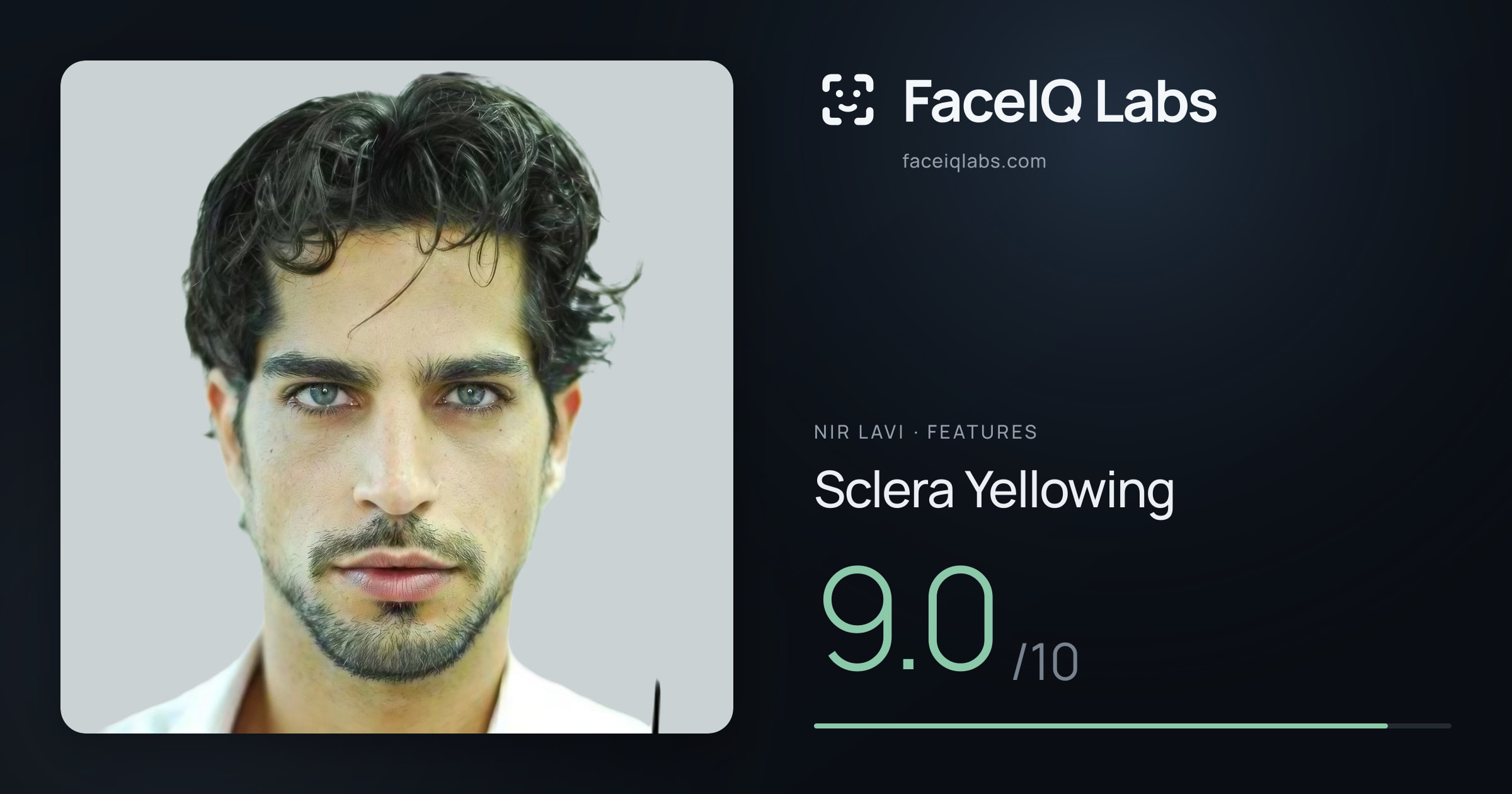 Nir Lavi Sclera Yellowing: 9.0/10, drawn on the photo