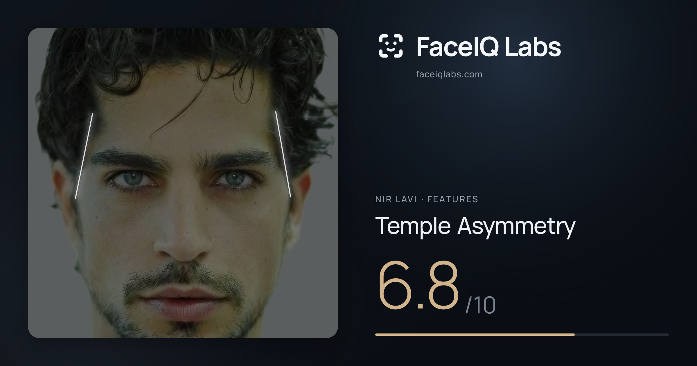 Nir Lavi Temple Asymmetry: 6.8/10, drawn on the photo