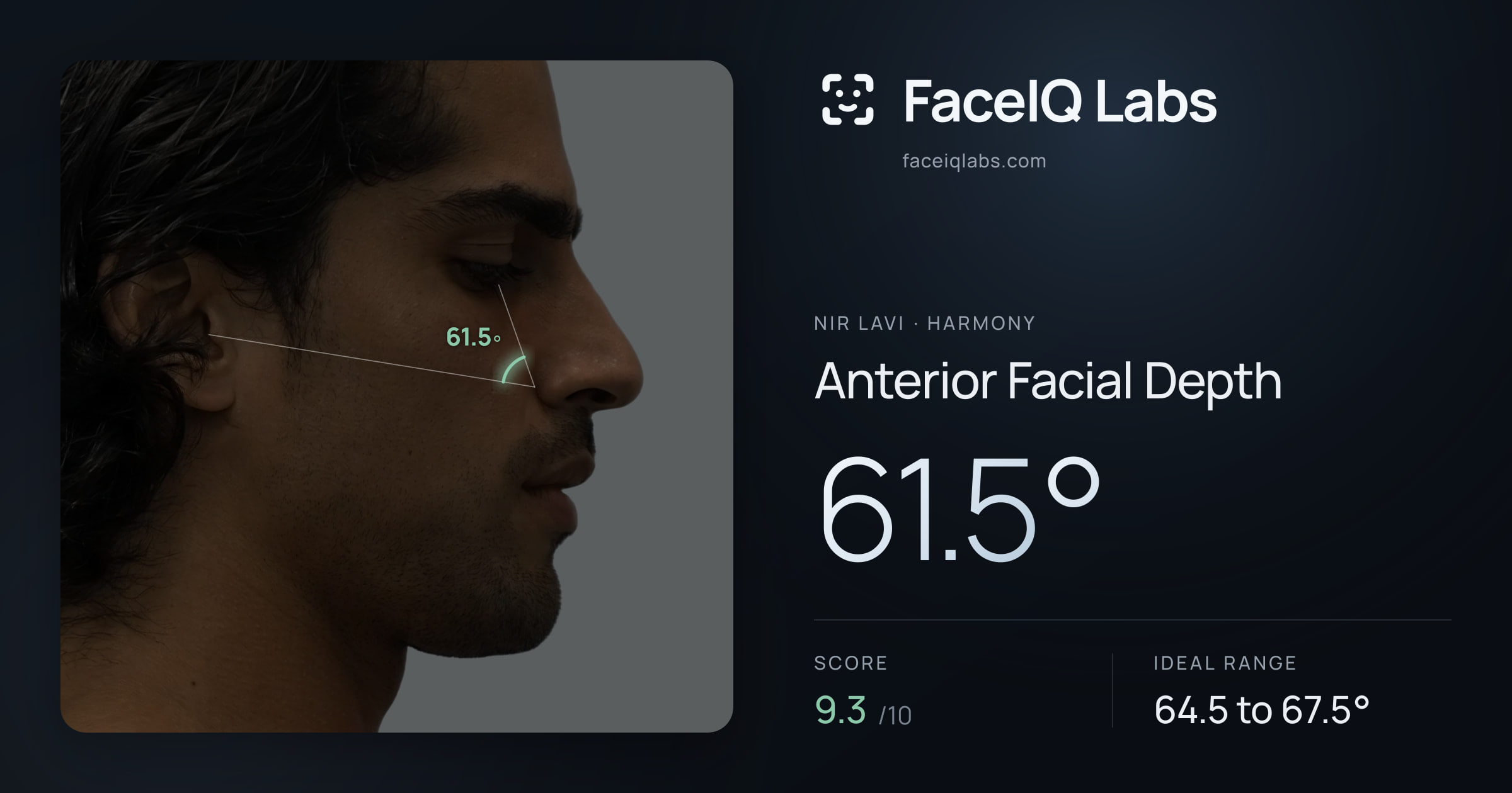Nir Lavi Anterior Facial Depth: 61.5°, drawn on the photo