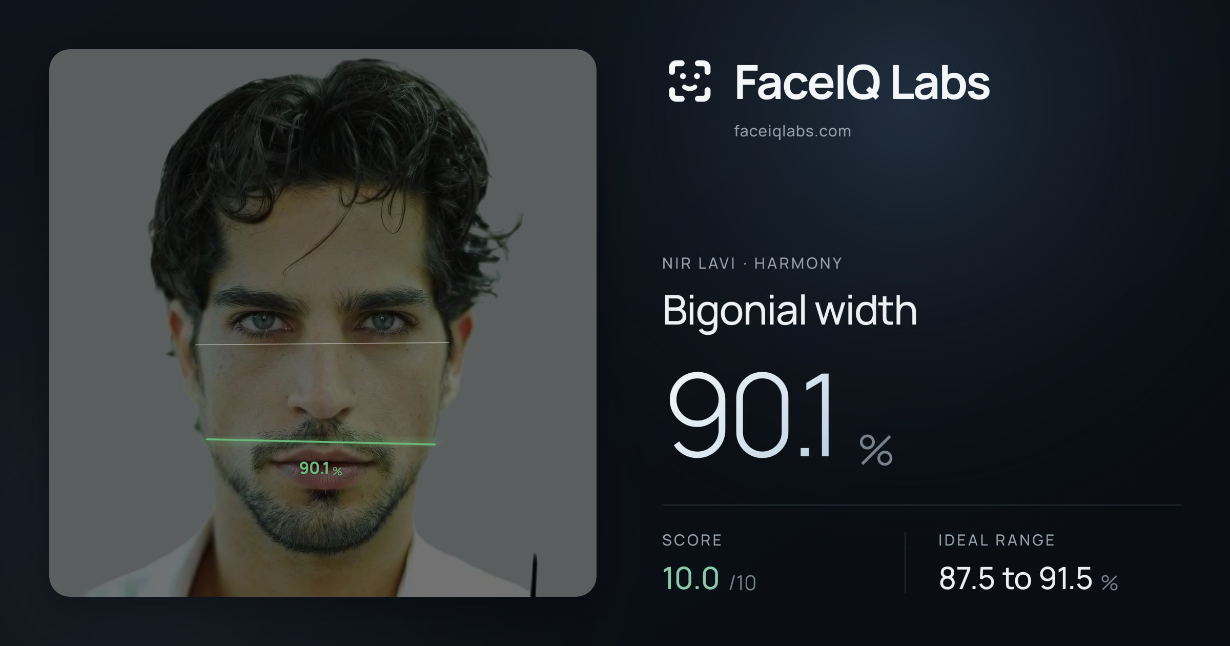 Nir Lavi Bigonial width: 90.1%, drawn on the photo