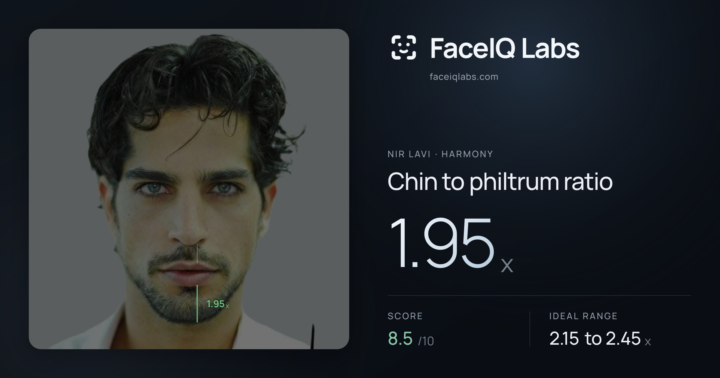 Nir Lavi Chin to philtrum ratio: 1.95x, drawn on the photo