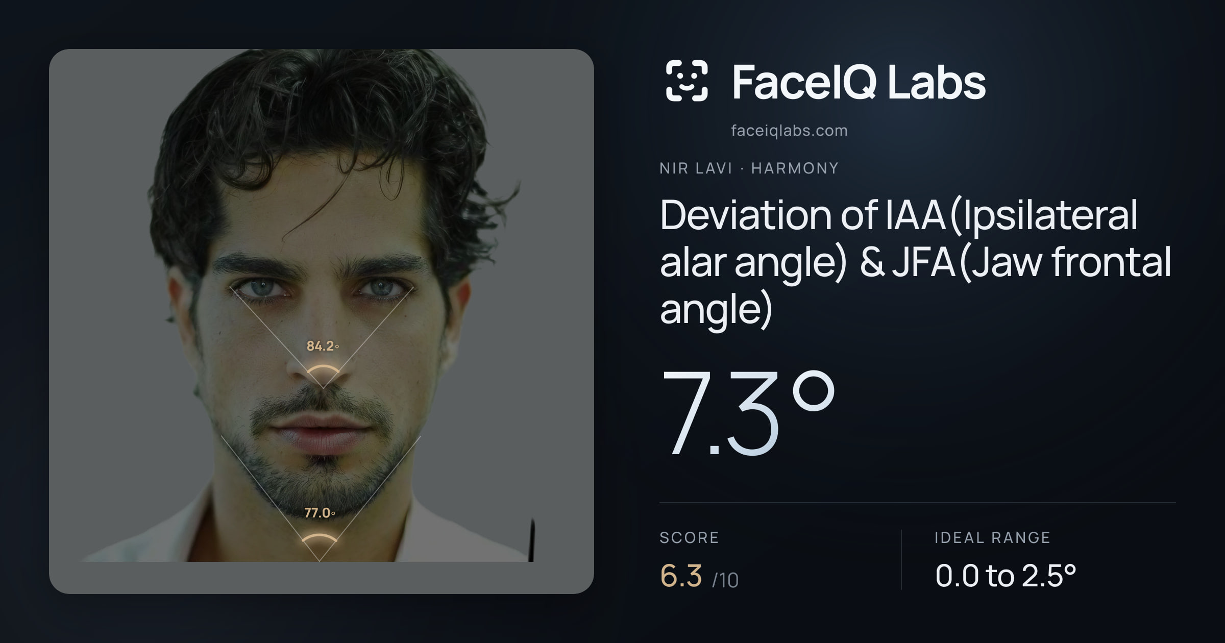 Nir Lavi Deviation of IAA(Ipsilateral alar angle) & JFA(Jaw frontal angle): 7.3°, drawn on the photo