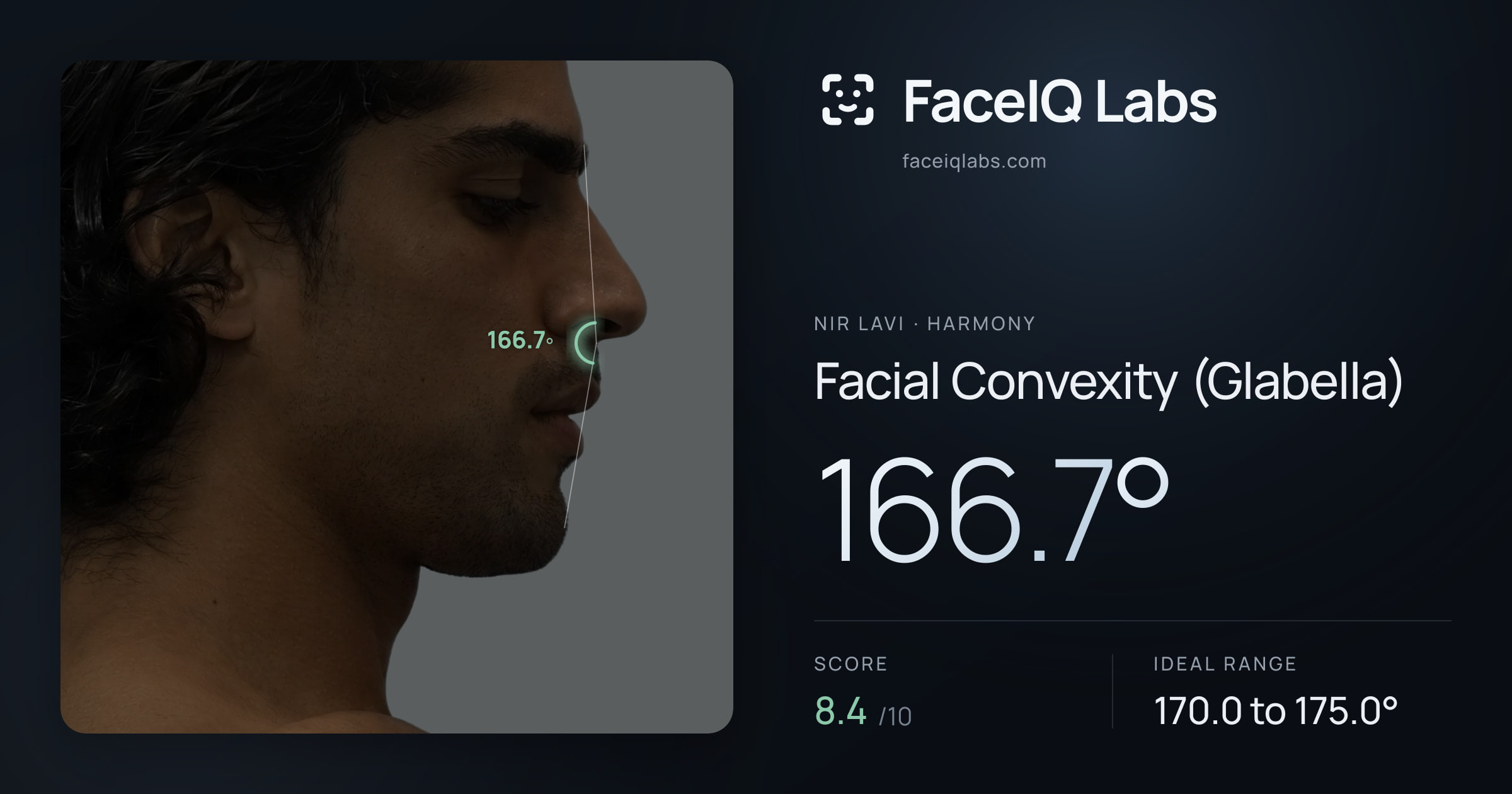 Nir Lavi Facial Convexity (Glabella): 166.7°, drawn on the photo