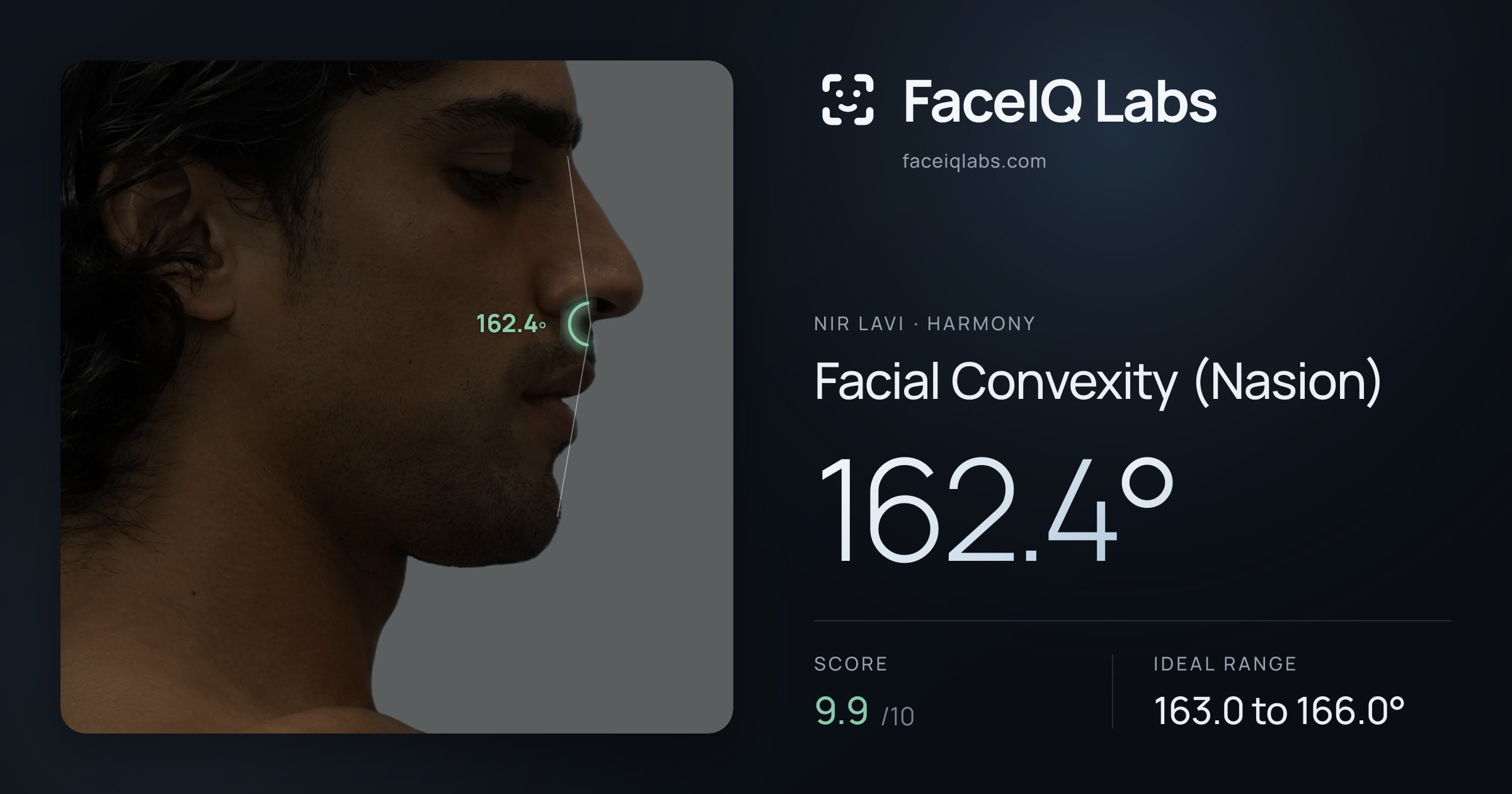 Nir Lavi Facial Convexity (Nasion): 162.4°, drawn on the photo