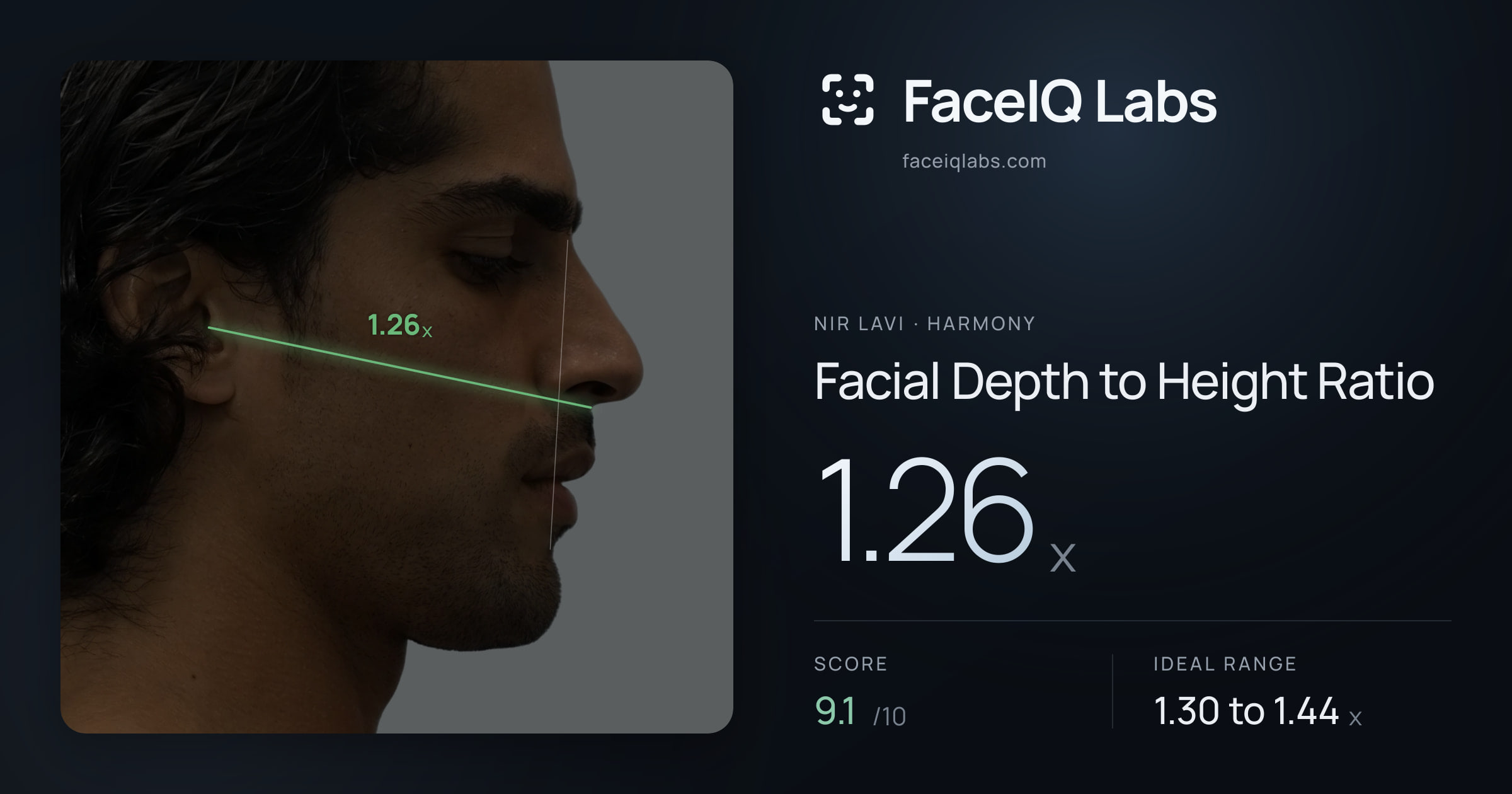 Nir Lavi Facial Depth to Height Ratio: 1.26x, drawn on the photo