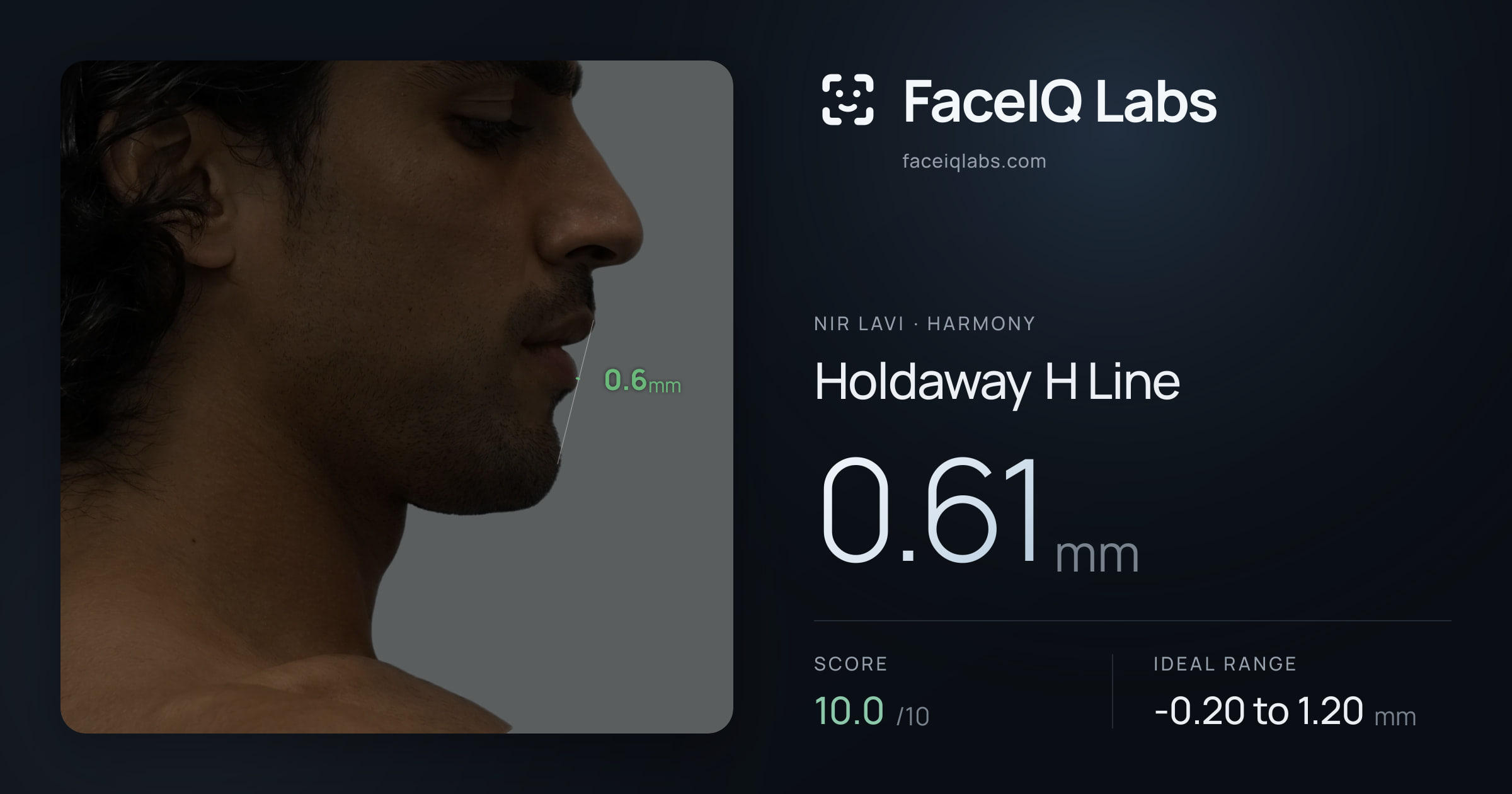 Nir Lavi Holdaway H Line: 0.61mm, drawn on the photo