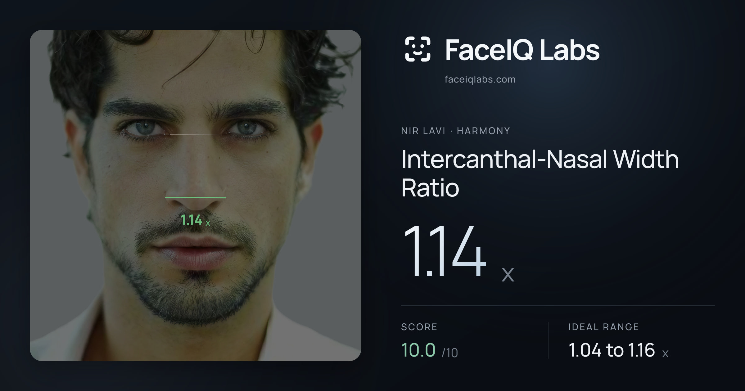 Nir Lavi Intercanthal-Nasal Width Ratio: 1.14x, drawn on the photo