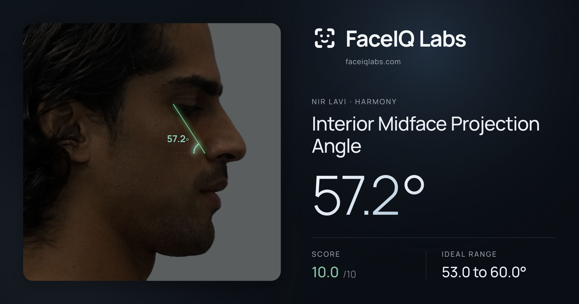 Nir Lavi Interior Midface Projection Angle: 57.2°, drawn on the photo