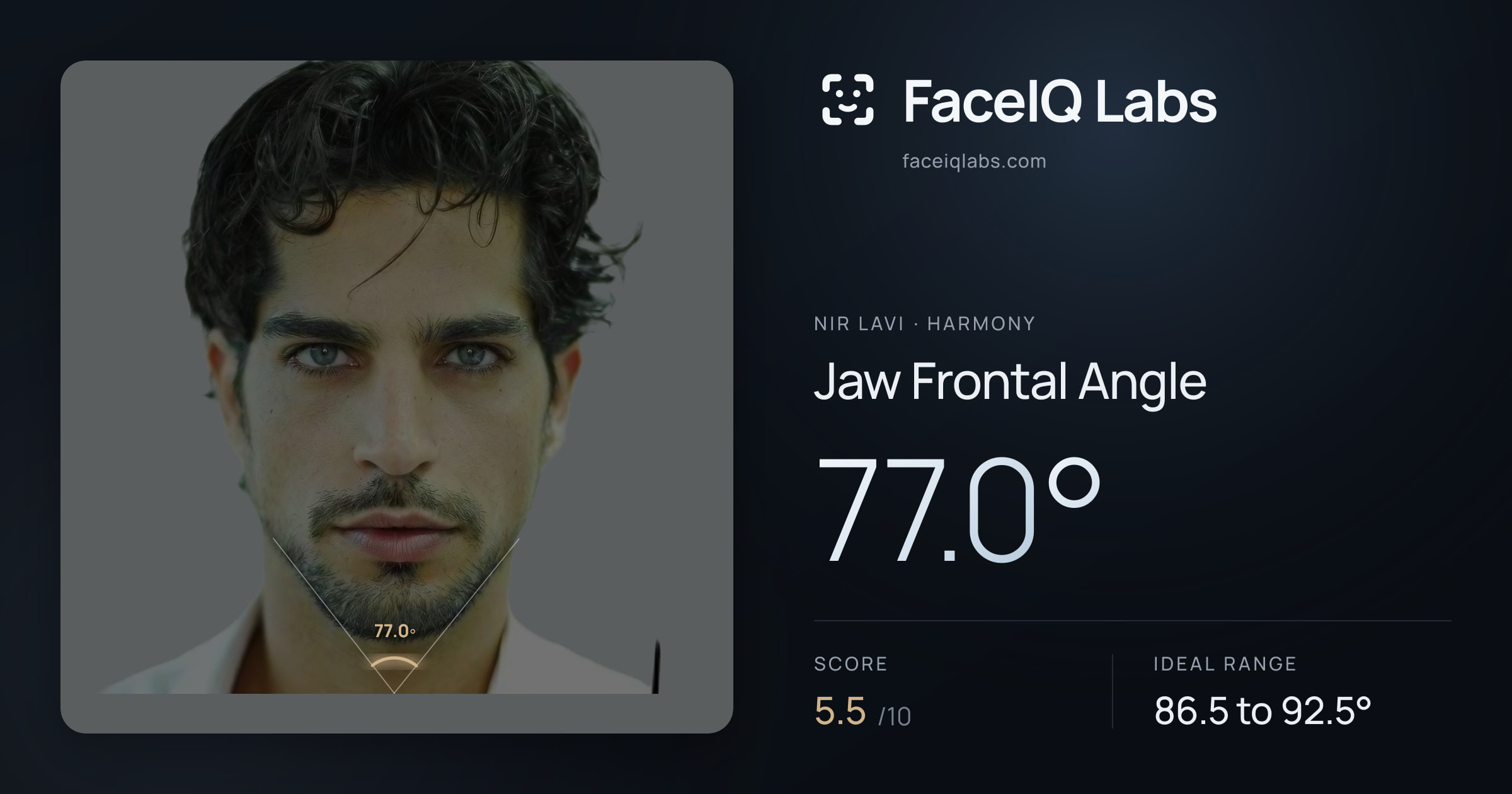 Nir Lavi Jaw Frontal Angle: 77.0°, drawn on the photo