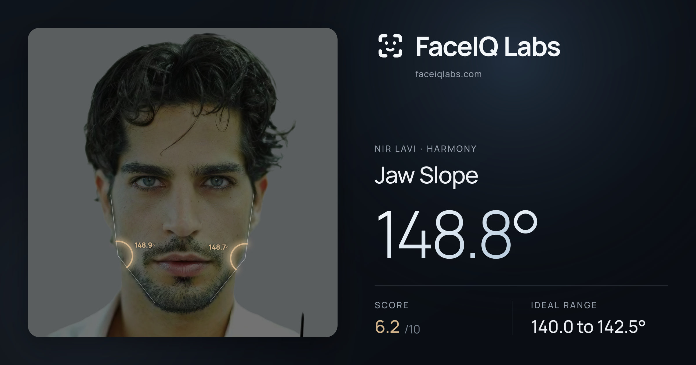 Nir Lavi Jaw Slope: 148.8°, drawn on the photo