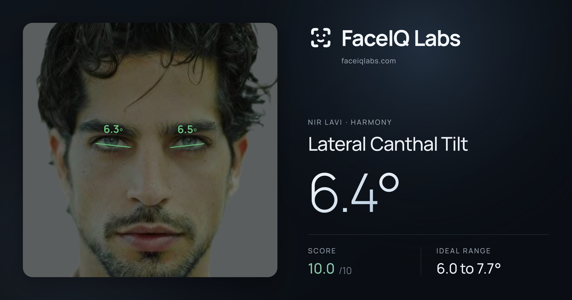 Nir Lavi Lateral Canthal Tilt: 6.4°, drawn on the photo
