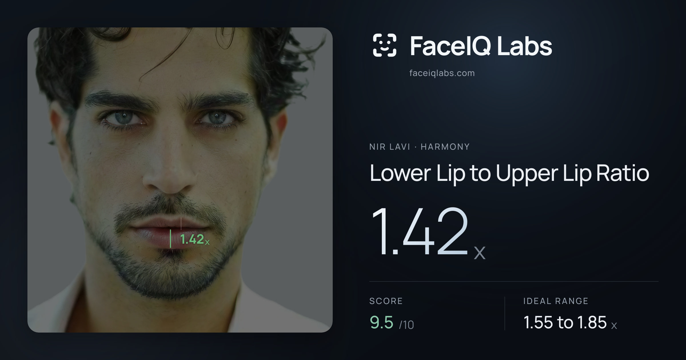 Nir Lavi Lower Lip to Upper Lip Ratio: 1.42x, drawn on the photo