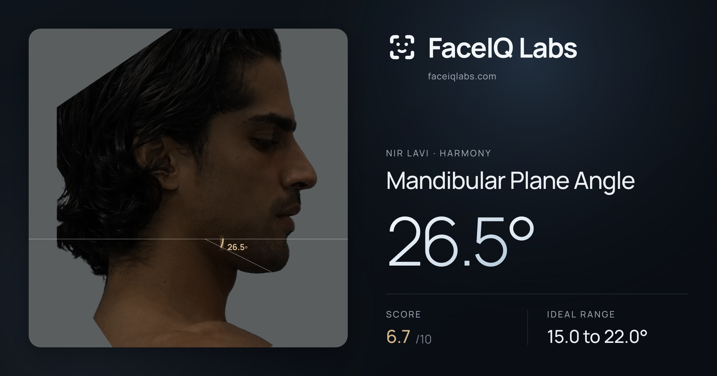Nir Lavi Mandibular Plane Angle: 26.5°, drawn on the photo