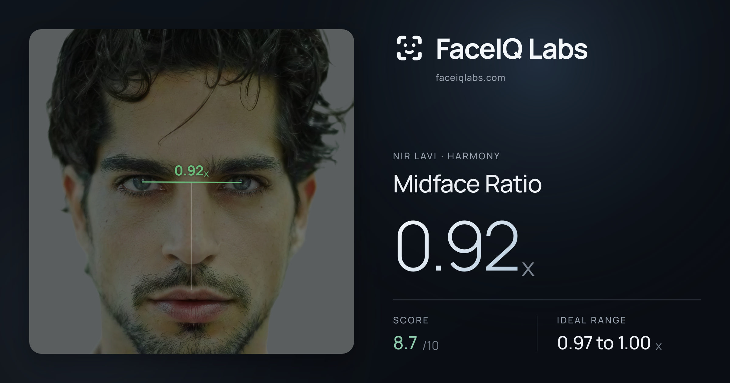 Nir Lavi Midface Ratio: 0.92x, drawn on the photo