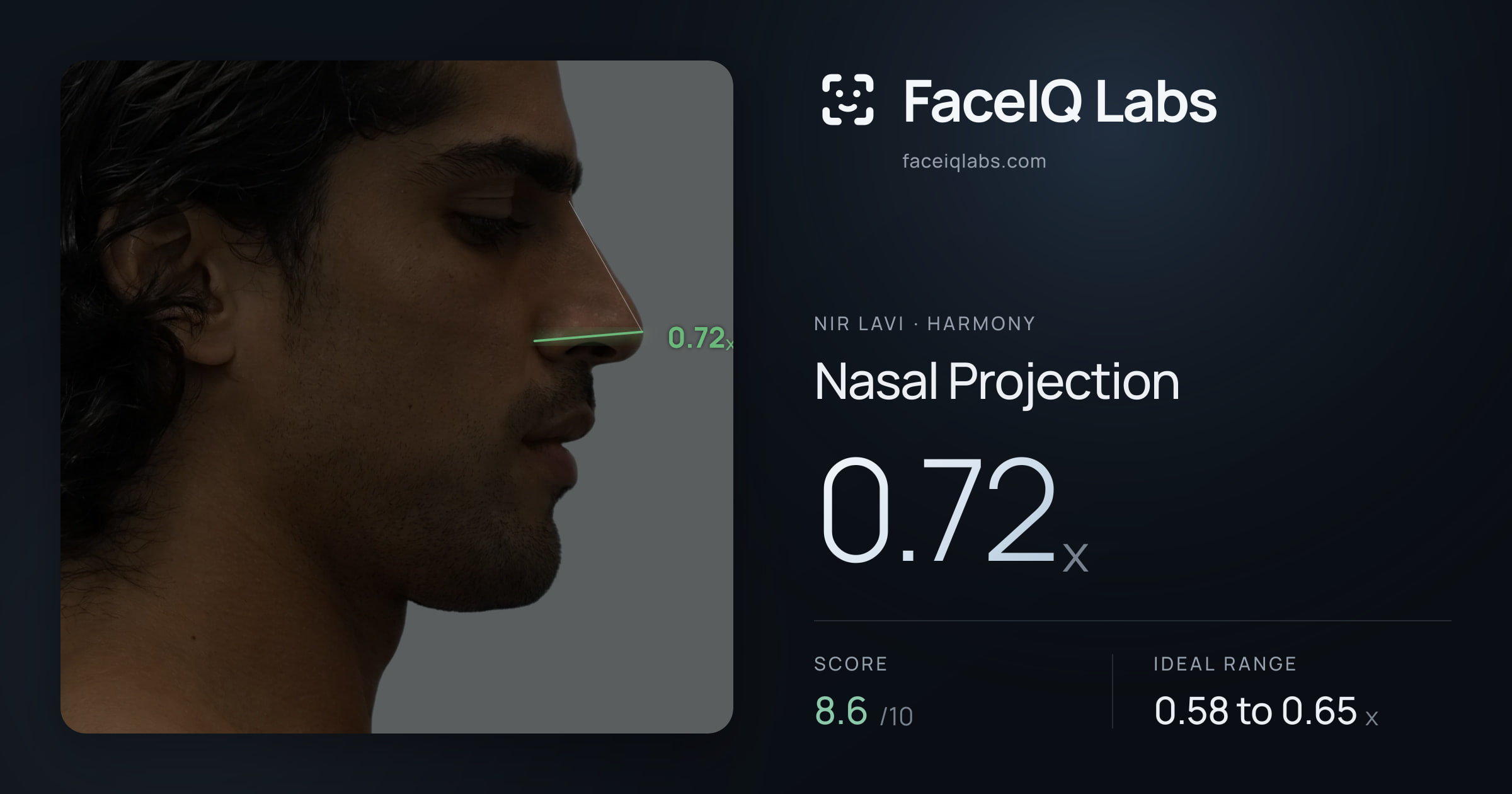 Nir Lavi Nasal Projection: 0.72x, drawn on the photo